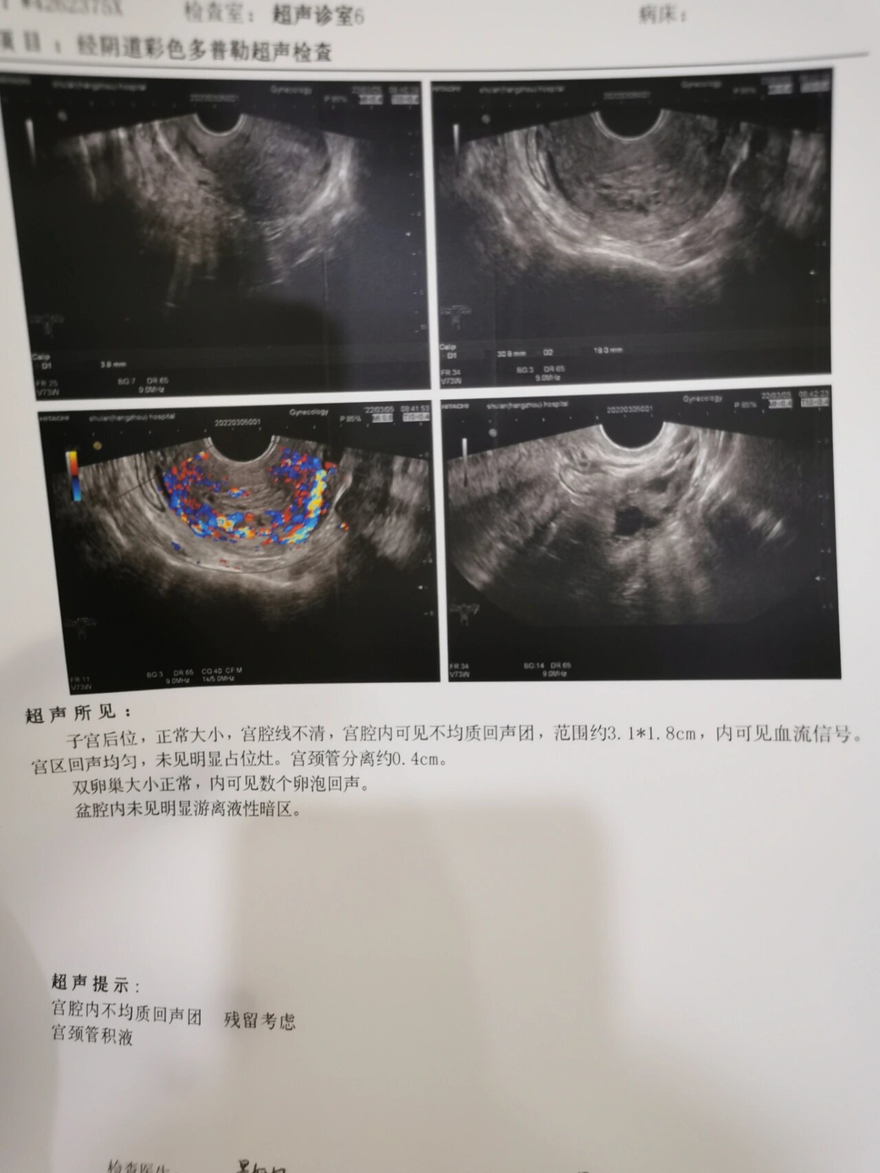 药流两周厚复查