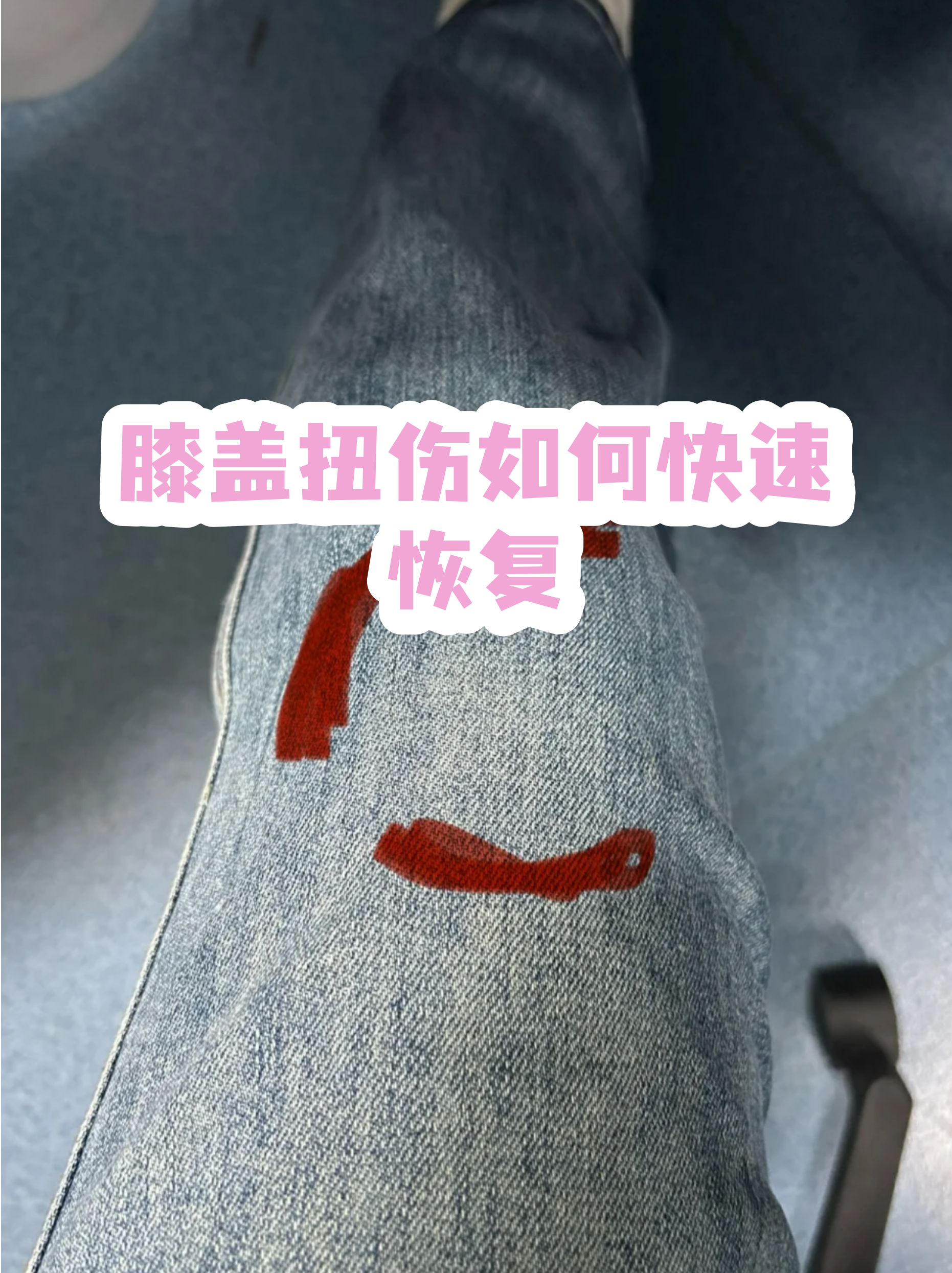 301医院代取报告代挂号术后康复全程跟踪，恢复不走弯路的简单介绍