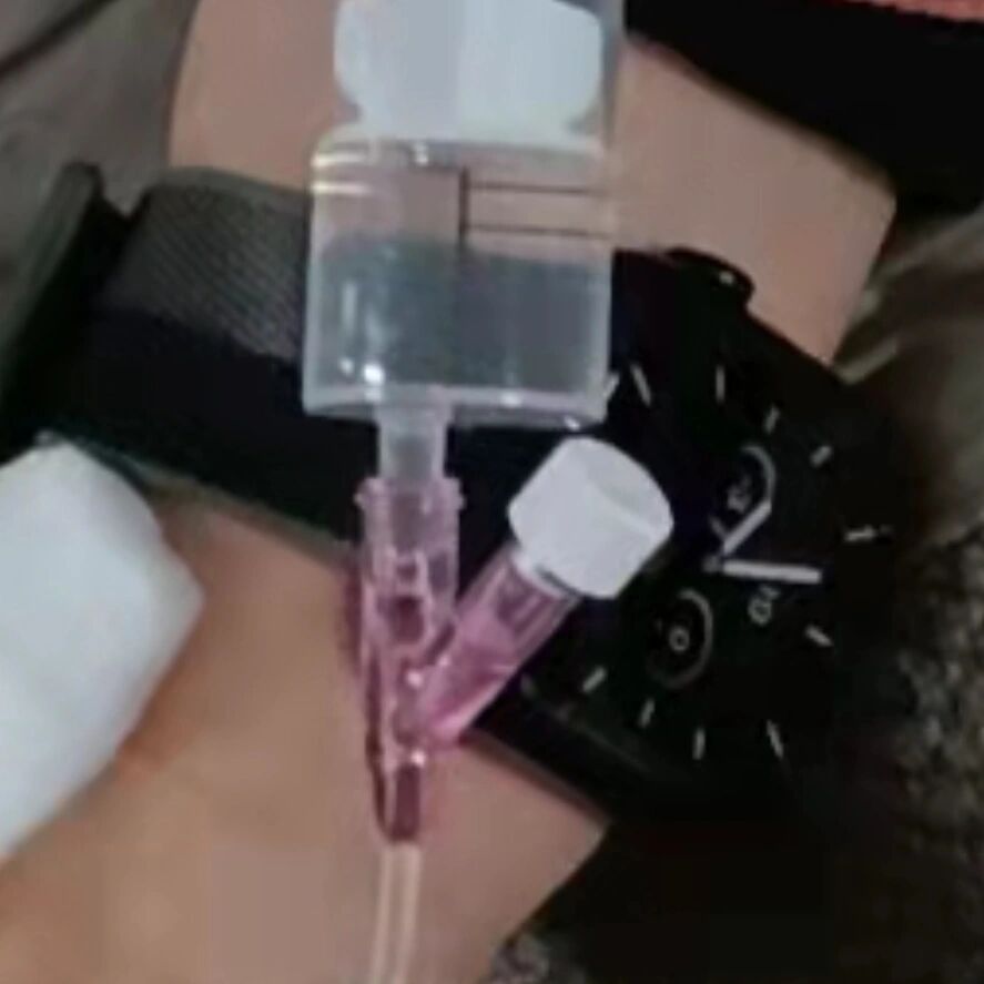 友谊医院穿刺预约-北京友谊医院做穿刺手术多少钱 