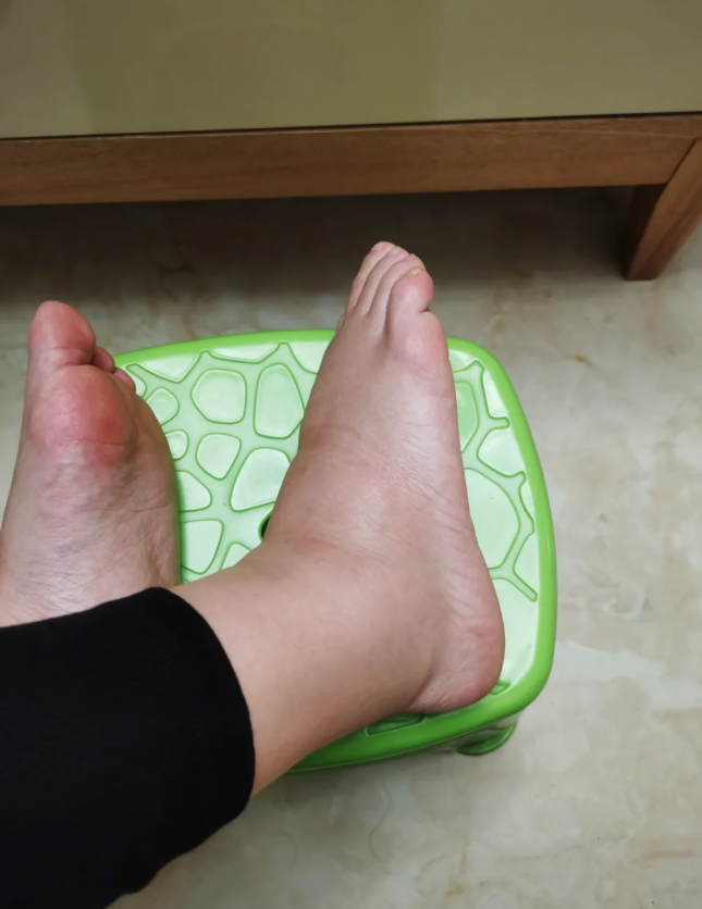老人如果长时间坐着或站着不动,腿部血液回流不畅,就容易脚肿