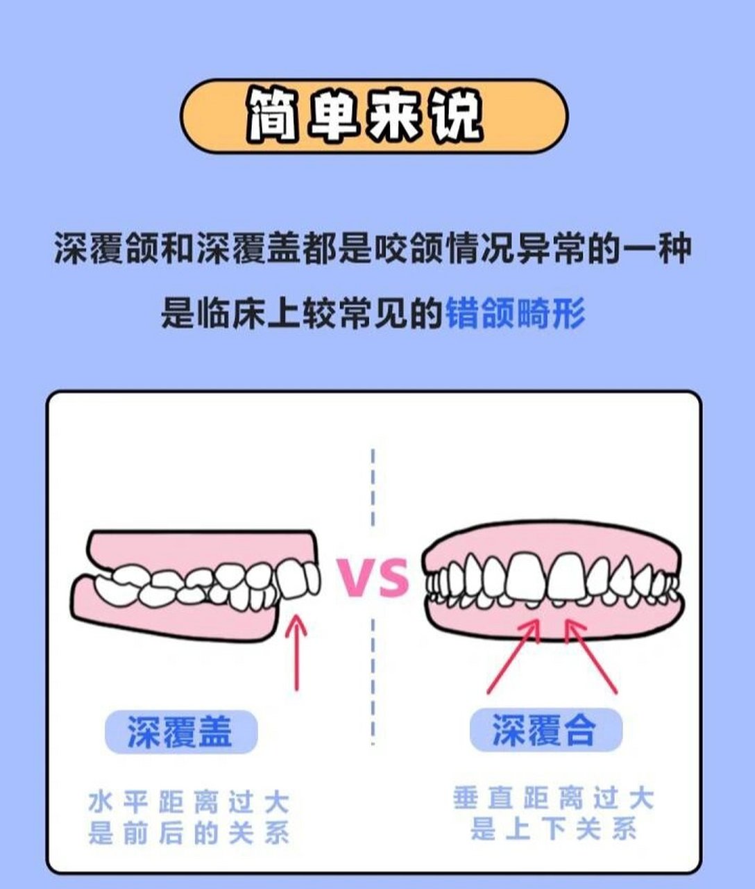 深覆合和深覆盖区别图片