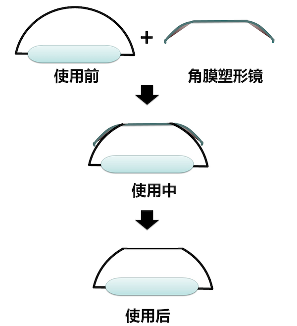 ok镜美国已经禁止了图片