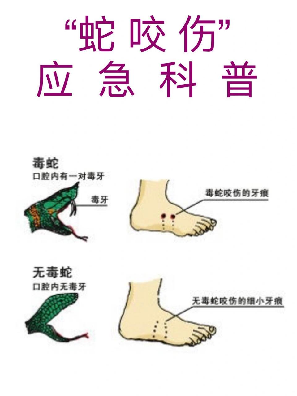 被蛇咬 卡通图片