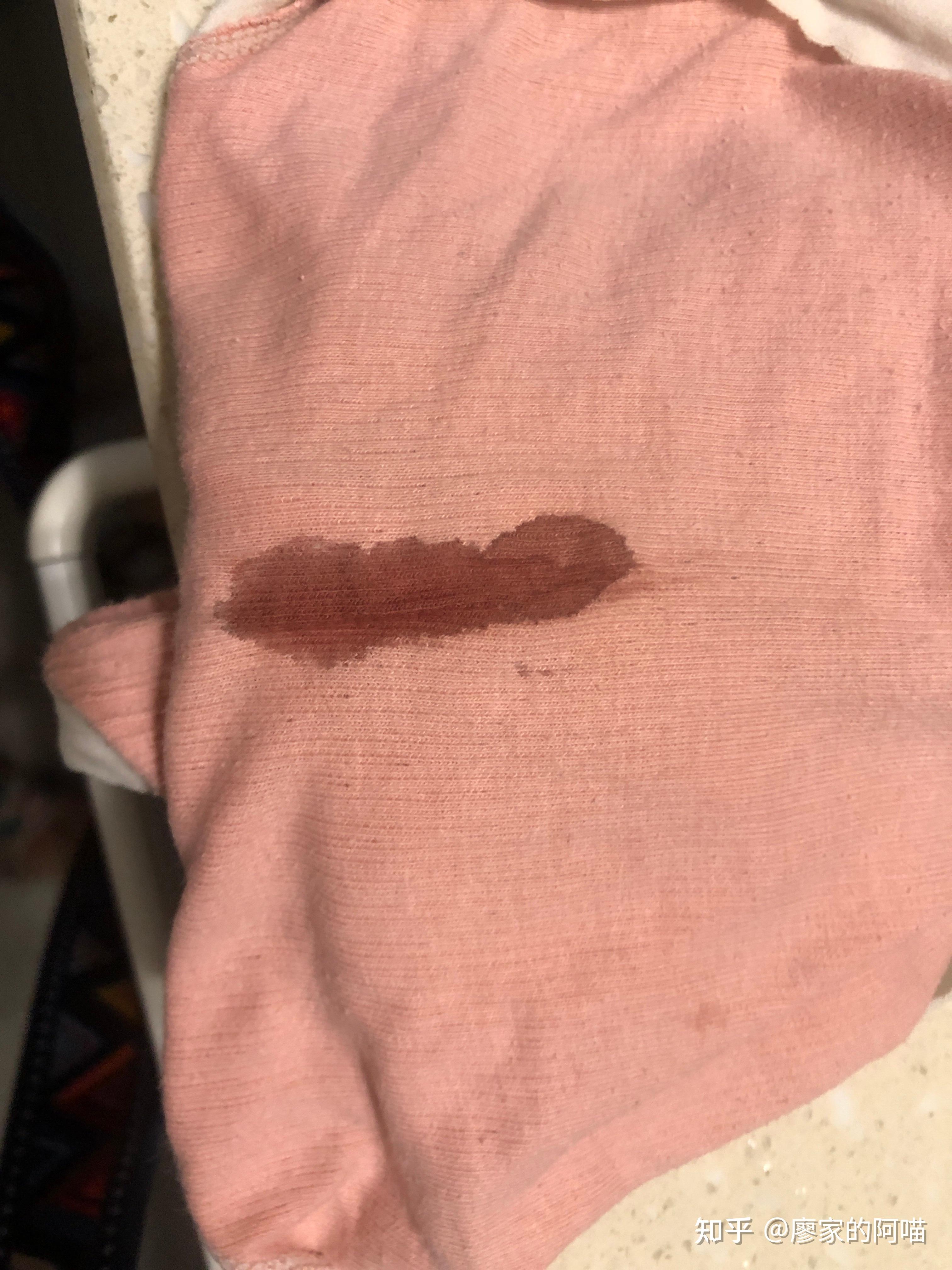 有少量的血又不是月经_少量流血不是月经无其他不适 有少量的血又不是月经_少量流血不是月经无其他不适 有少量的血又不是月经_少量流血不是月经无其他不适 磁力资讯