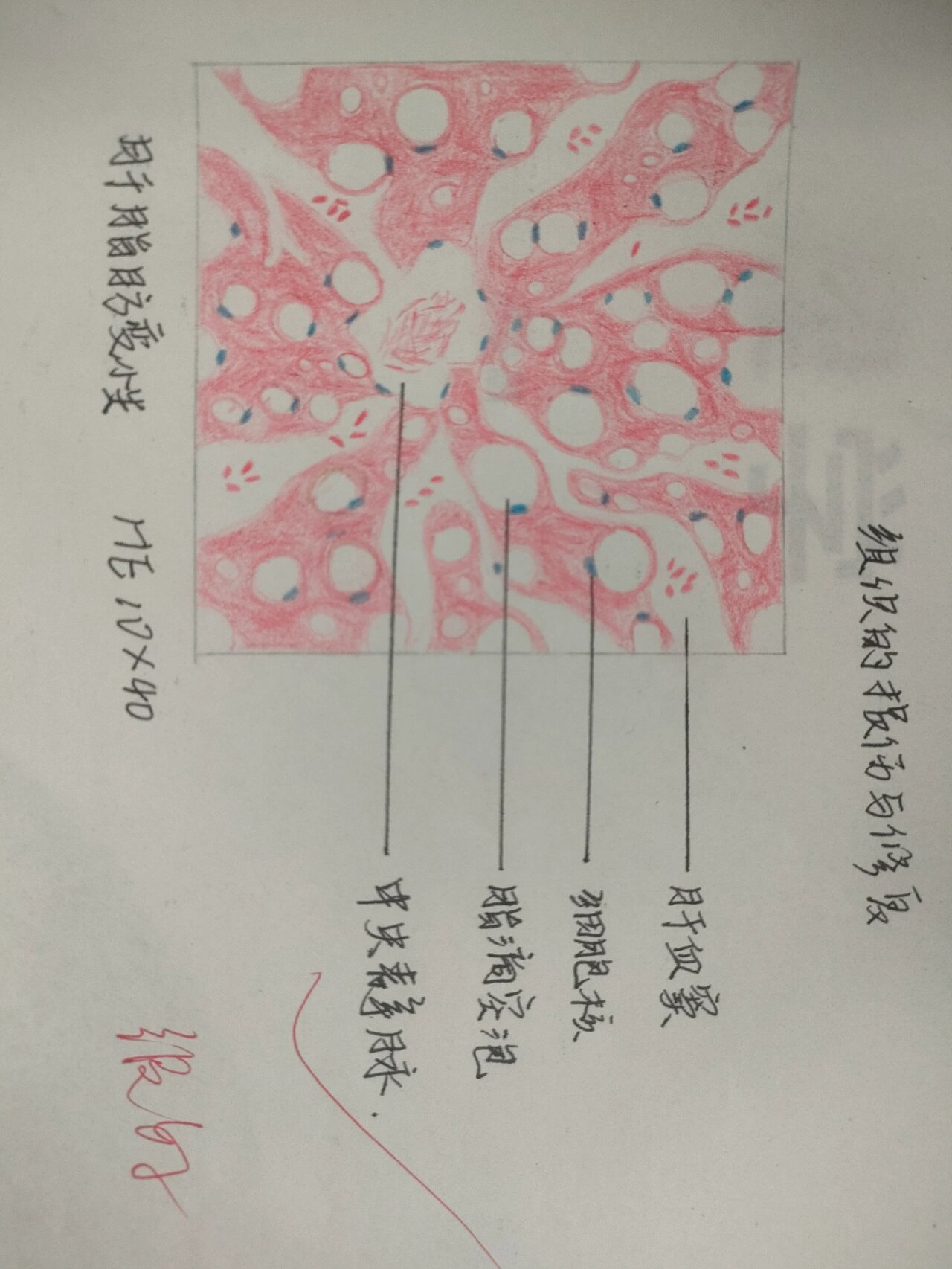 脂肪变性红蓝铅笔图图片