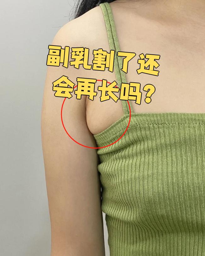 副乳切除后通常不会复发,但具体情况因人而异