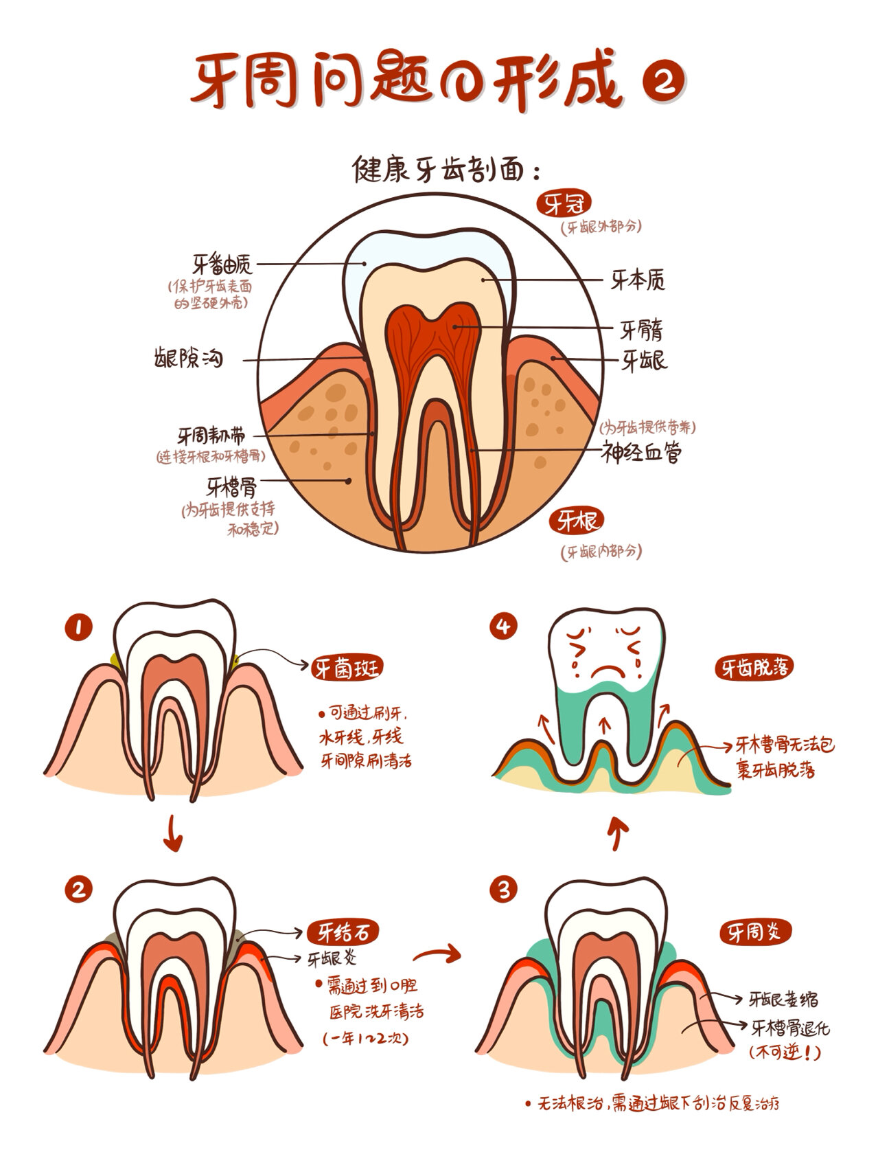 牙周刮治的治疗步骤图图片