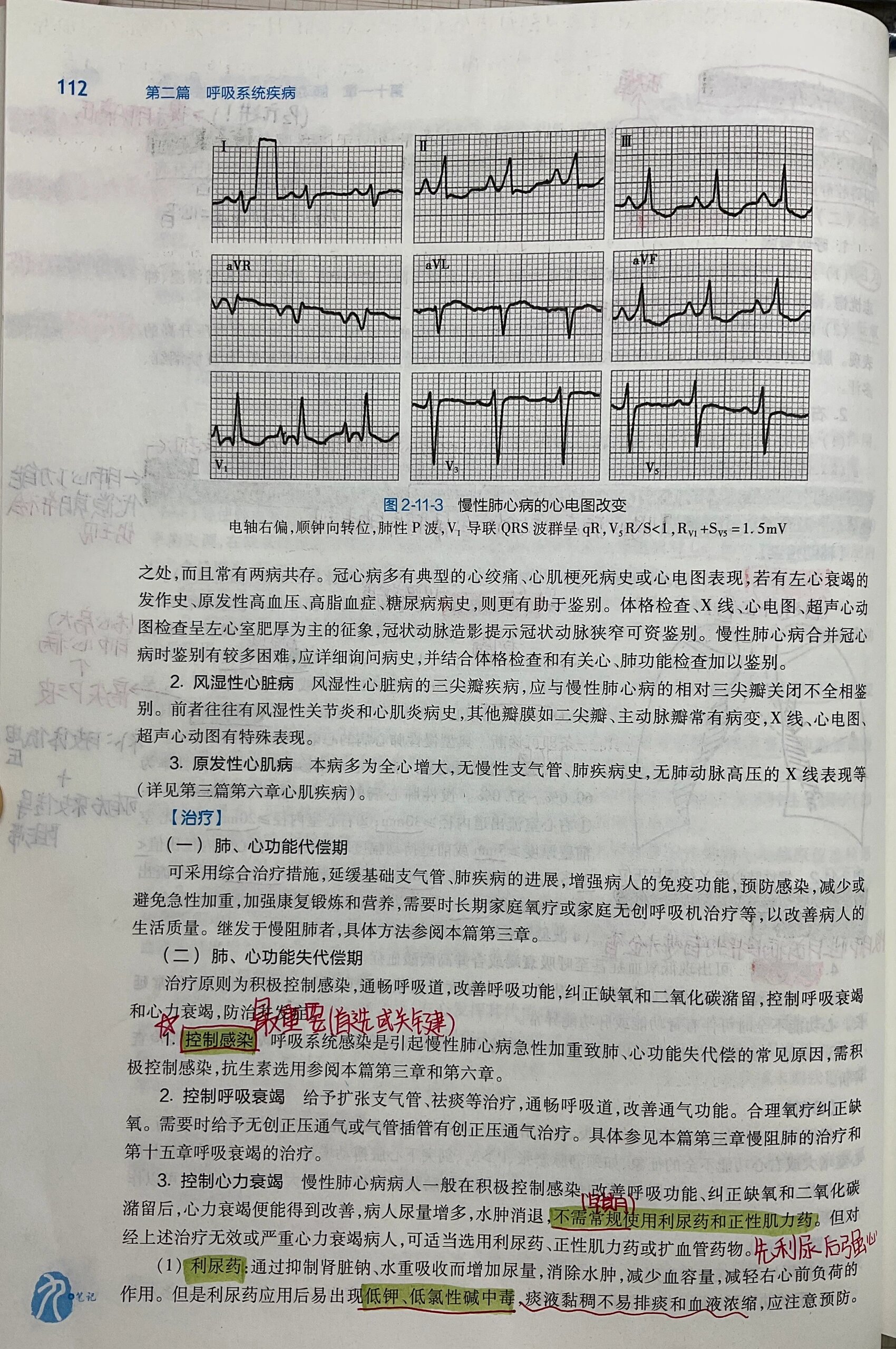 内科学|第十一章 肺动脉高压和肺源性心脏病 昭昭老师听课笔记77