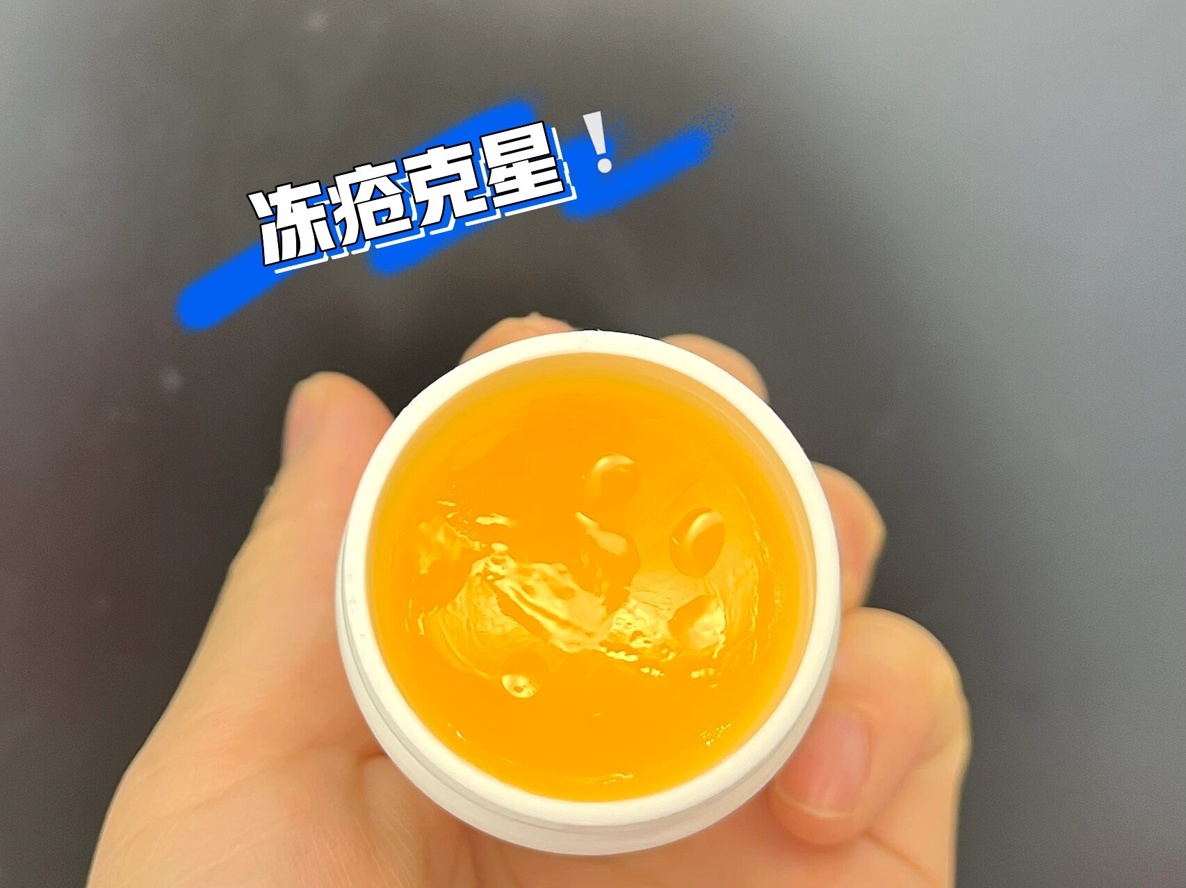 冻疮怎么根治 06有脚后跟开裂疼痛困扰的一定要不错过 这款佳必得康
