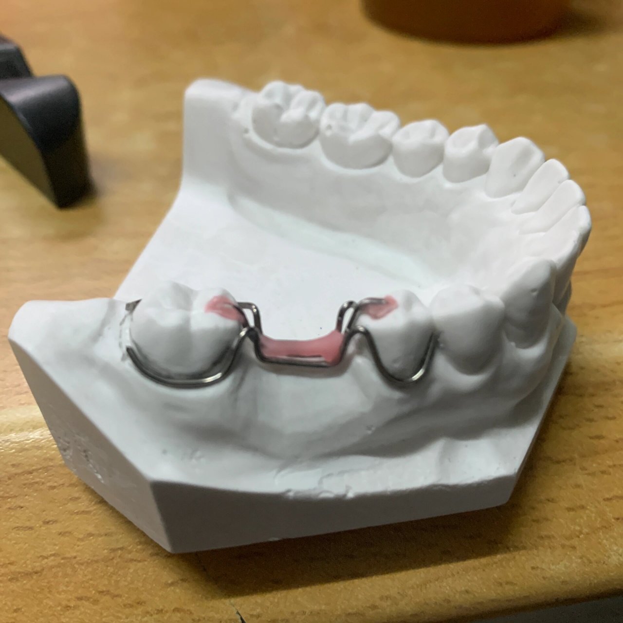 三臂卡环 牙合支托 一杆成型 有分段式四卡环和一杆成行做法,有需要