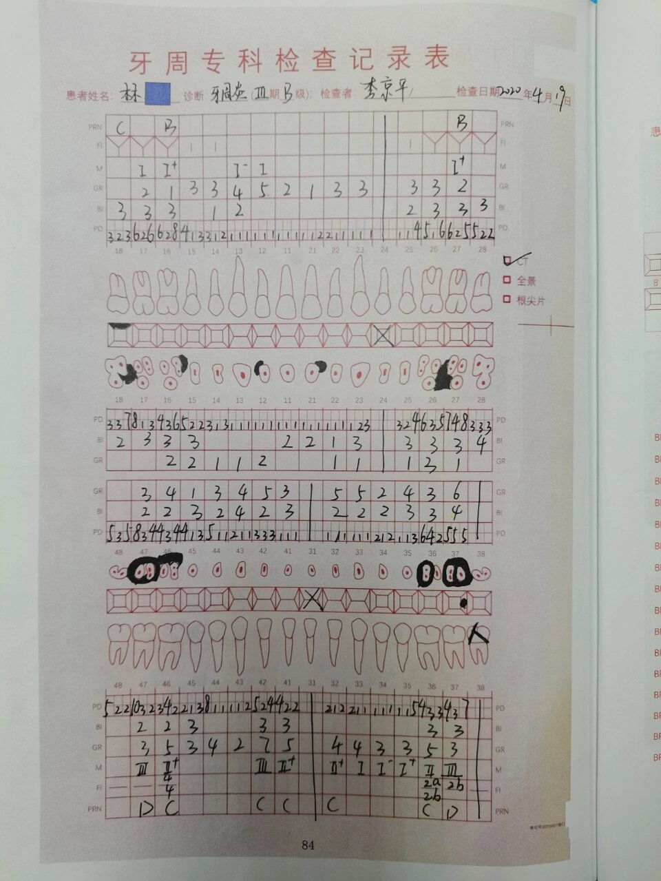 口腔器械之牙周专科检查表