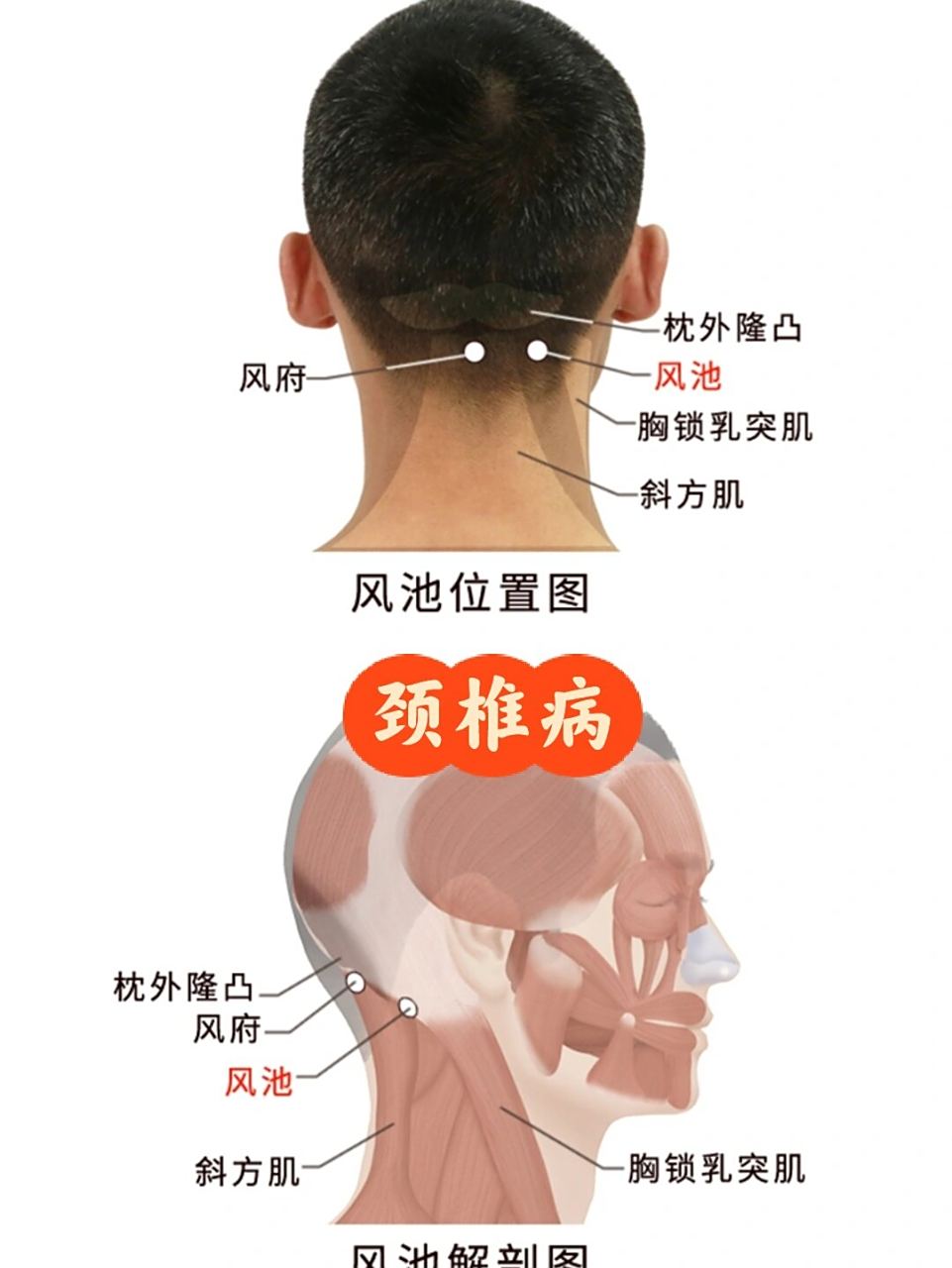 风池和天柱的位置图图片