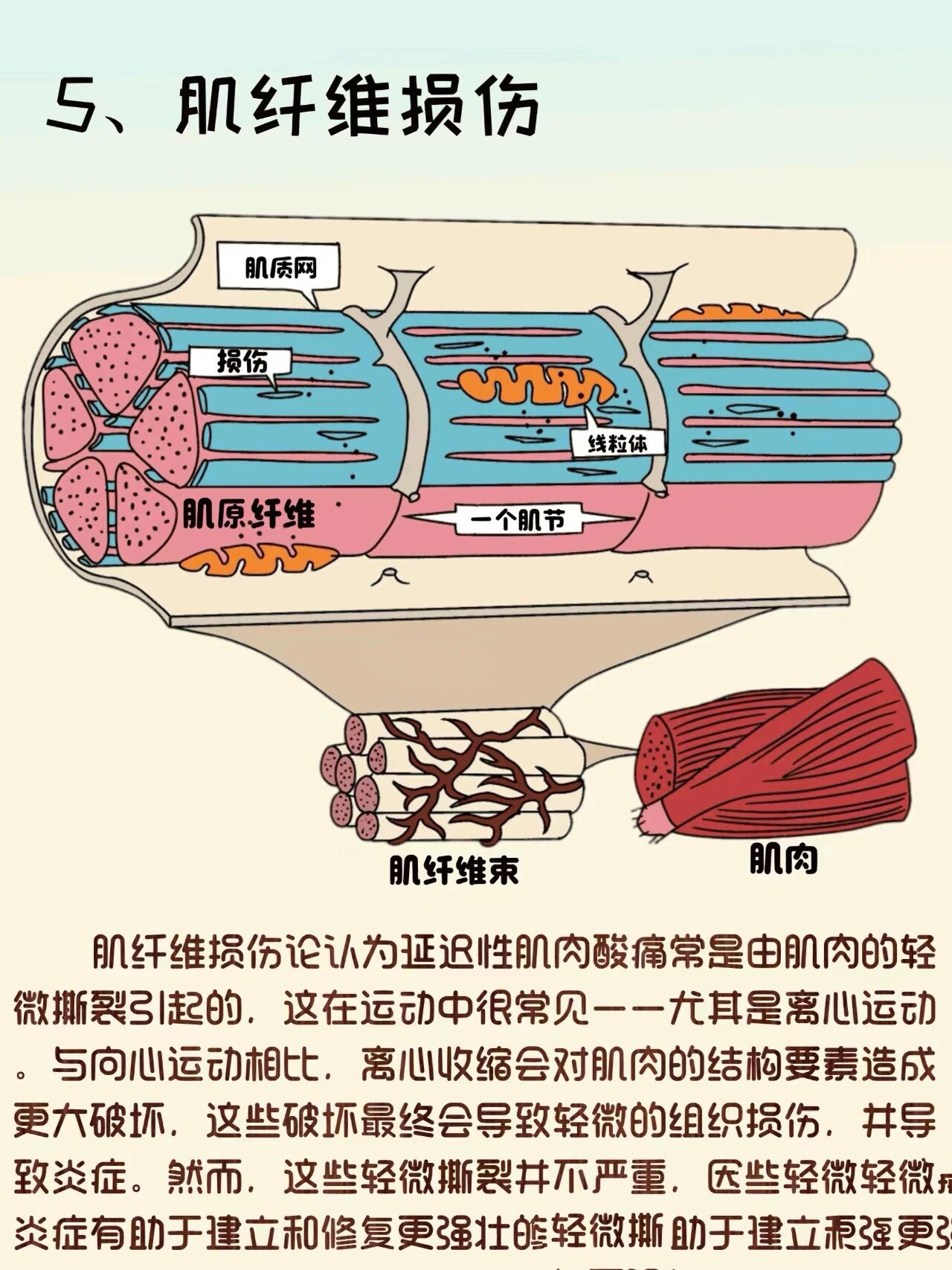 肩颈乳酸堆积图片