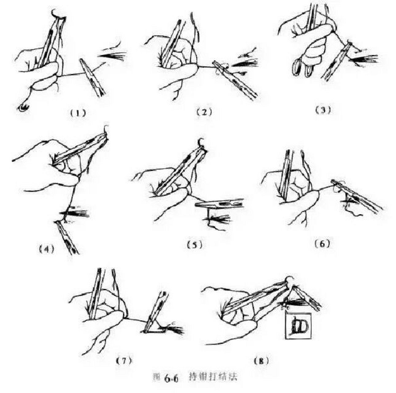 外科单手打结步骤图解图片