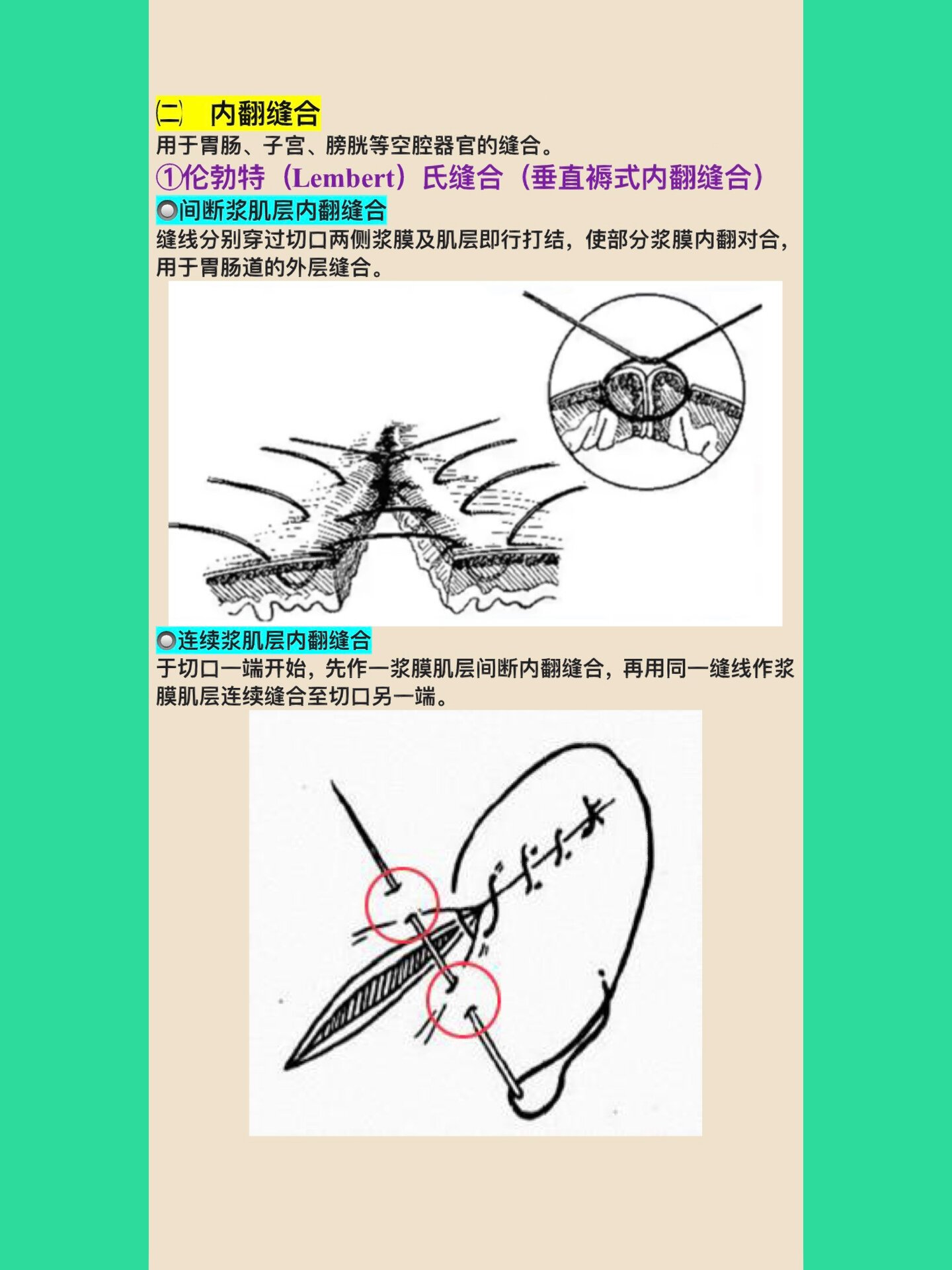 外科13种缝合方法图解图片