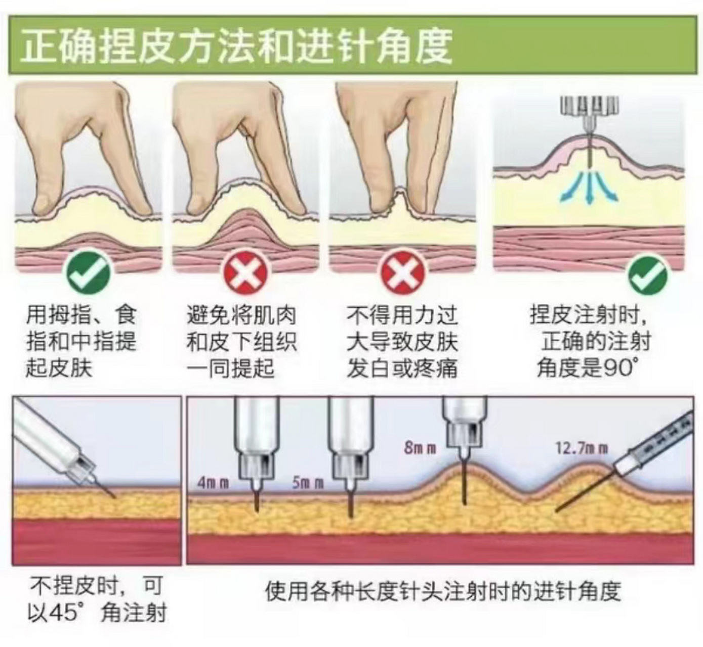 一分钟教你给狗狗打胰岛素,一点也不难!
