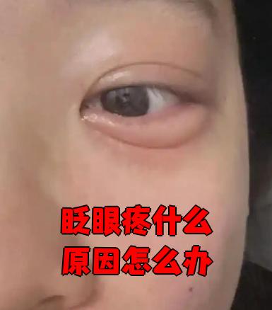 眨眼疼什么原因怎么办