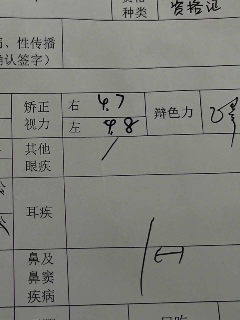 矫正后的视力一个4.7一个4.8可以过教资体检的视力吗好担心需要5.