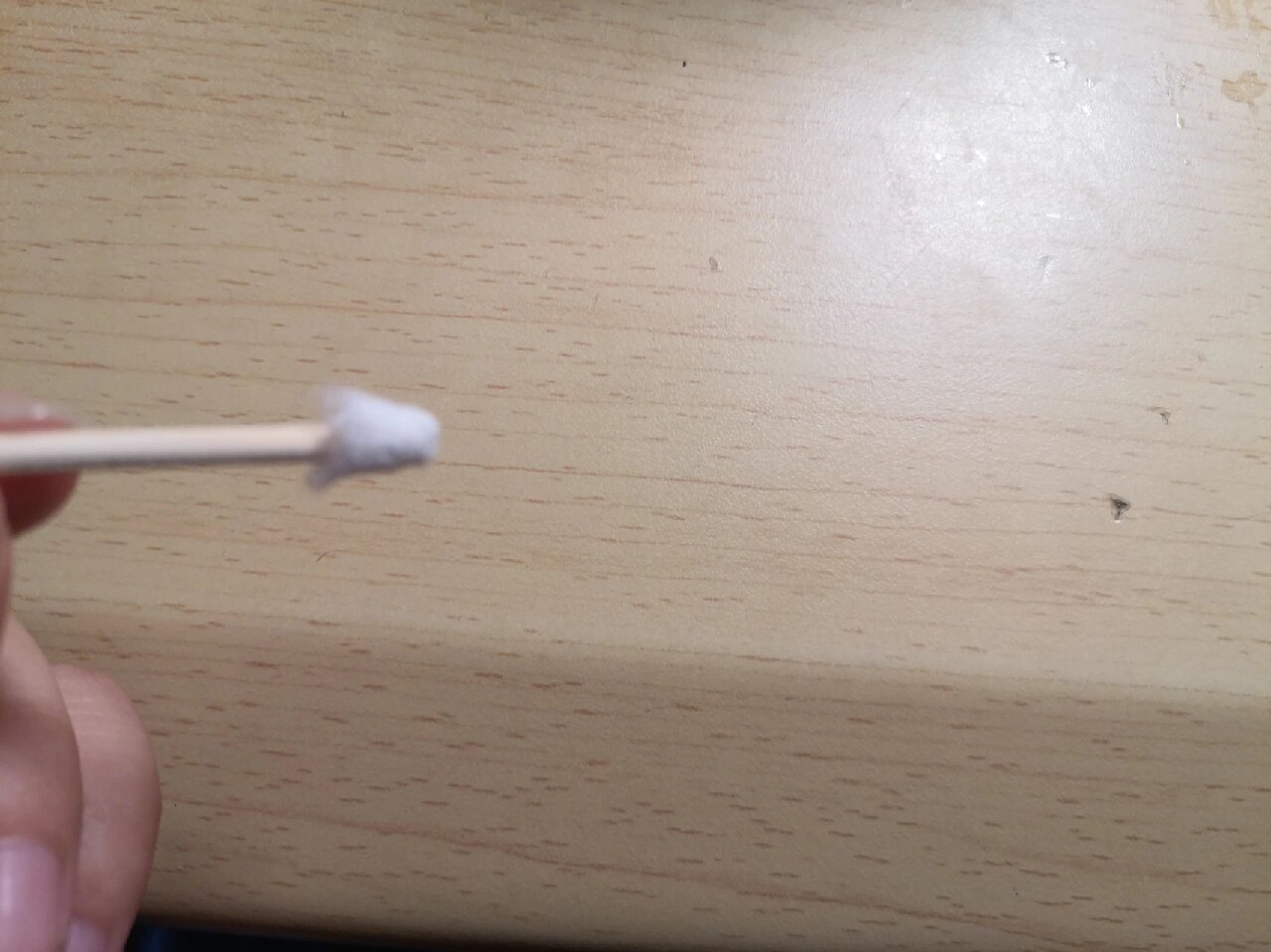 前段时间粘了舌侧扣 靠里面的大牙 一直刮舌头吃饭 说话都超级痛苦