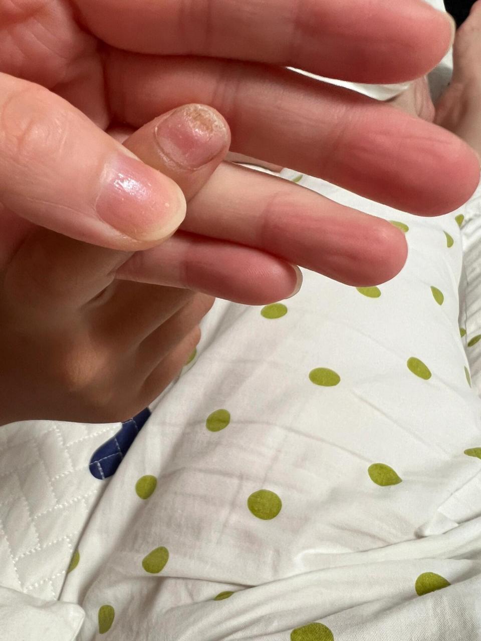 长出来的指甲都是好的.大家不妨试试.