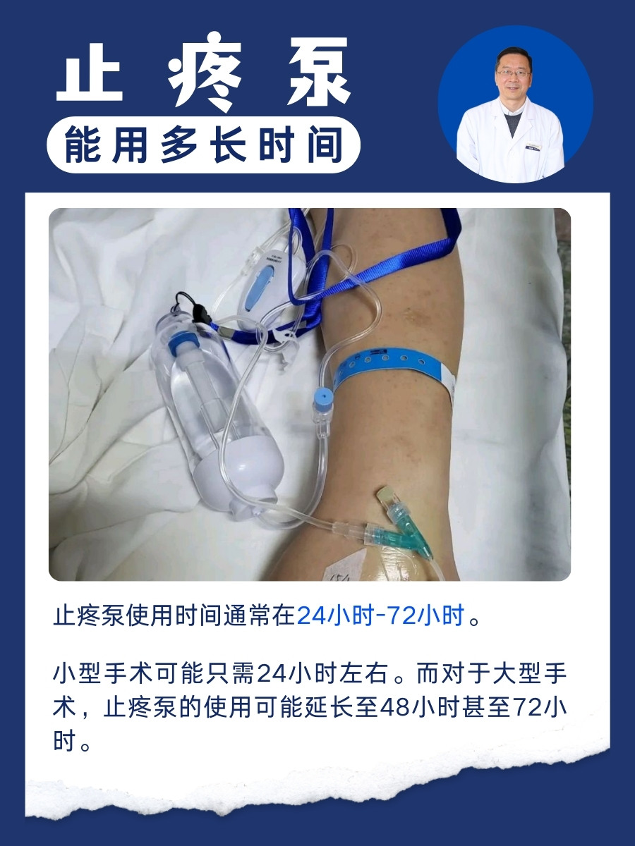 医生解答:止疼泵能用多长时间 随着医疗技术的不断发展,止疼泵已成为
