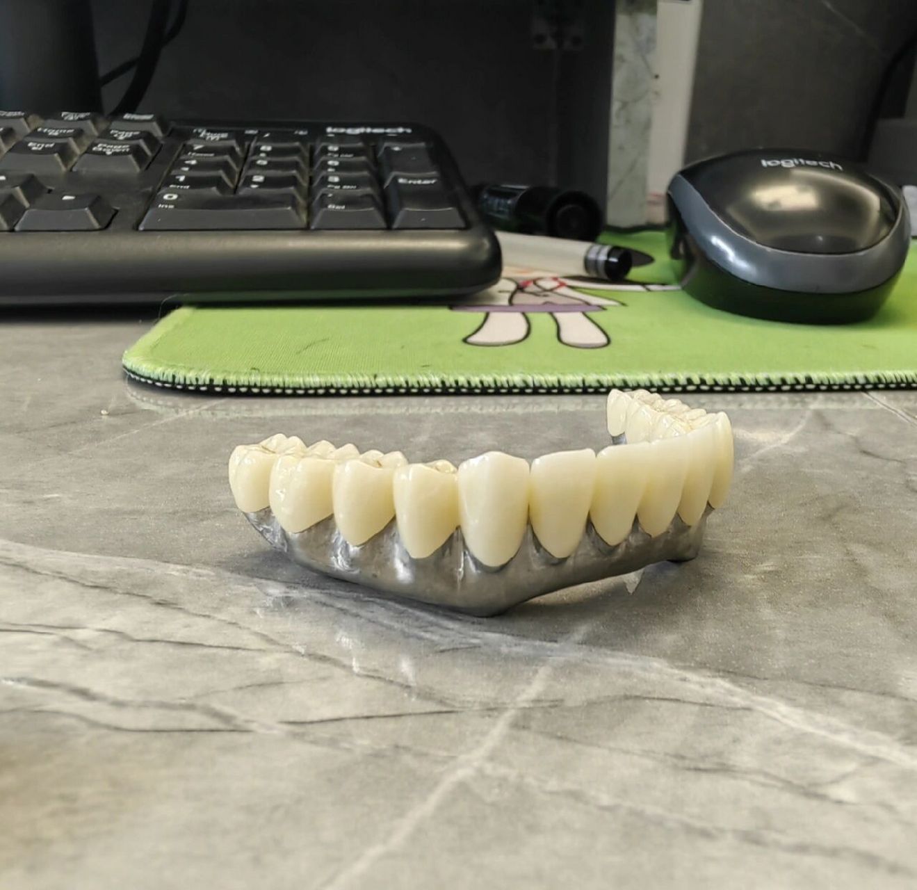 半口种植使用桥架的好处 半口种植牙桥架的好处: 稳定牢固,检修容易