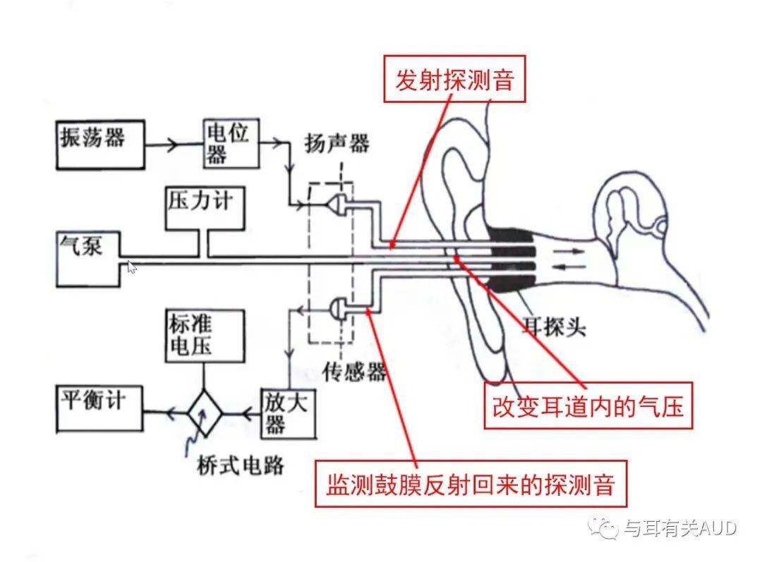 声导抗之鼓室图原理介绍及结果解读 鼓室图是声导抗测试的一部分,是