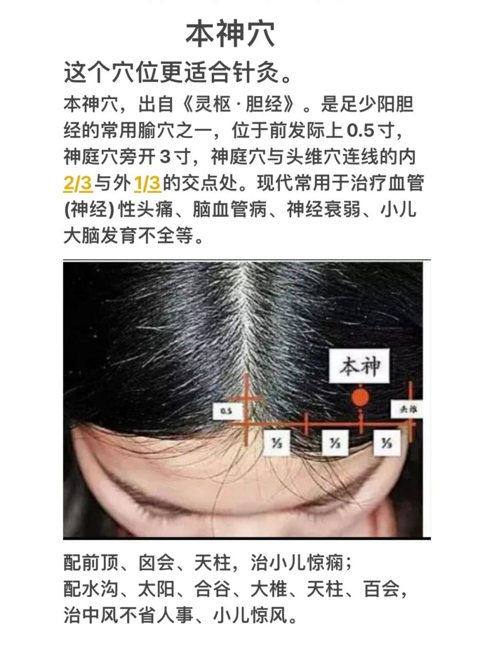 本神的准确位置图片图