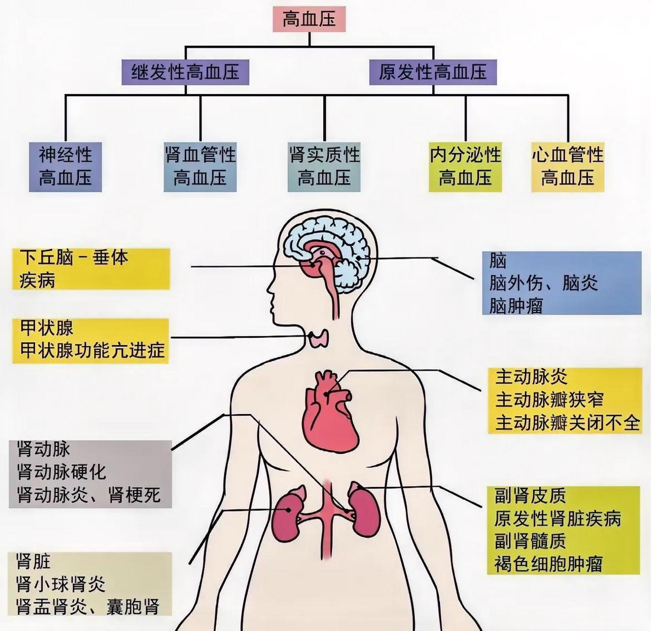 原发性高血压什么意思(原发性高血压什么意思?)