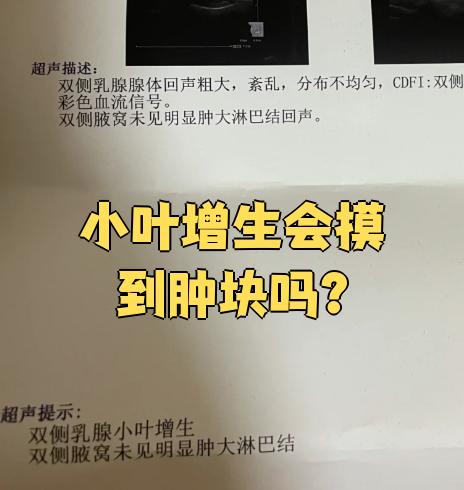 乳腺小叶增生患者经常会摸到肿块