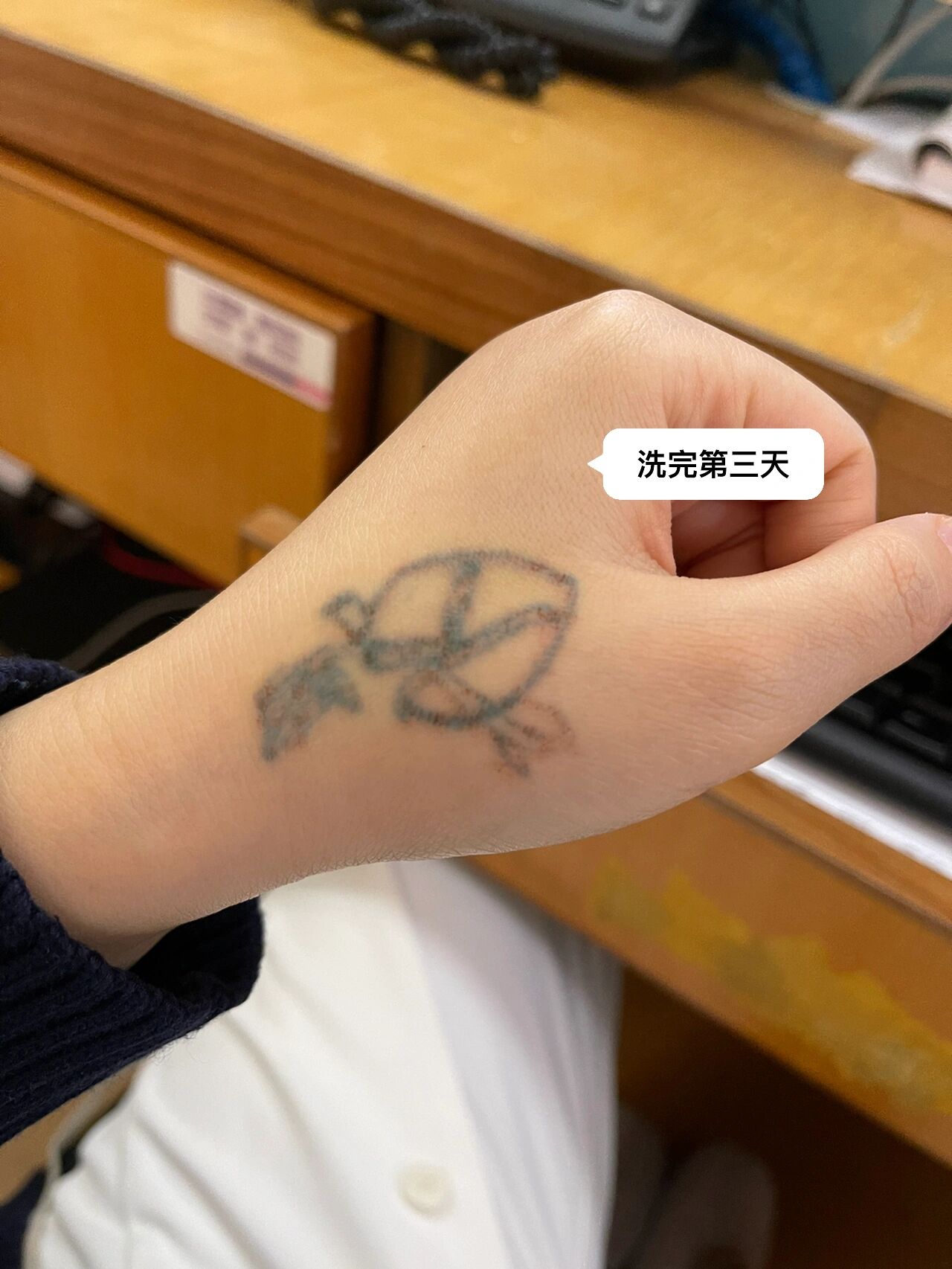 关于洗纹身 洗纹身的第一天 敷了麻药,还是很痛,但是比不敷麻药强一点