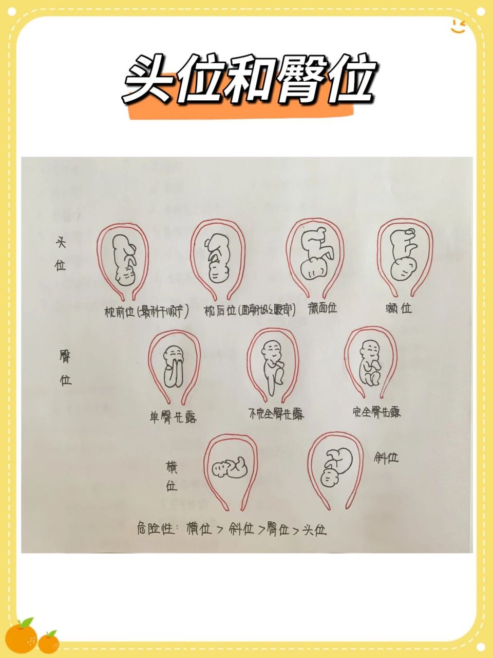 11566什么是胎位检查,头位,臀位,横位,斜位有什么区别 	 215