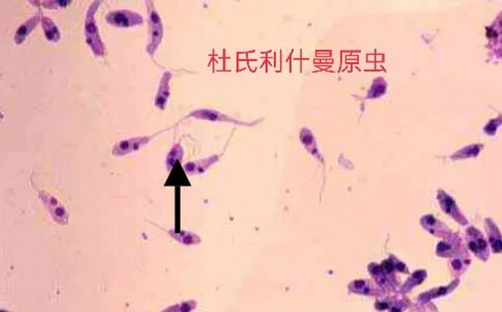 day11杜氏利什曼原虫