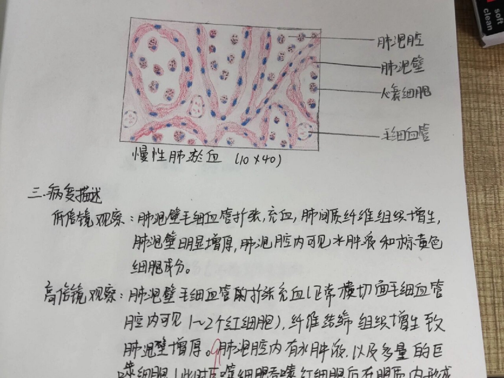 肺淤血绘图图片