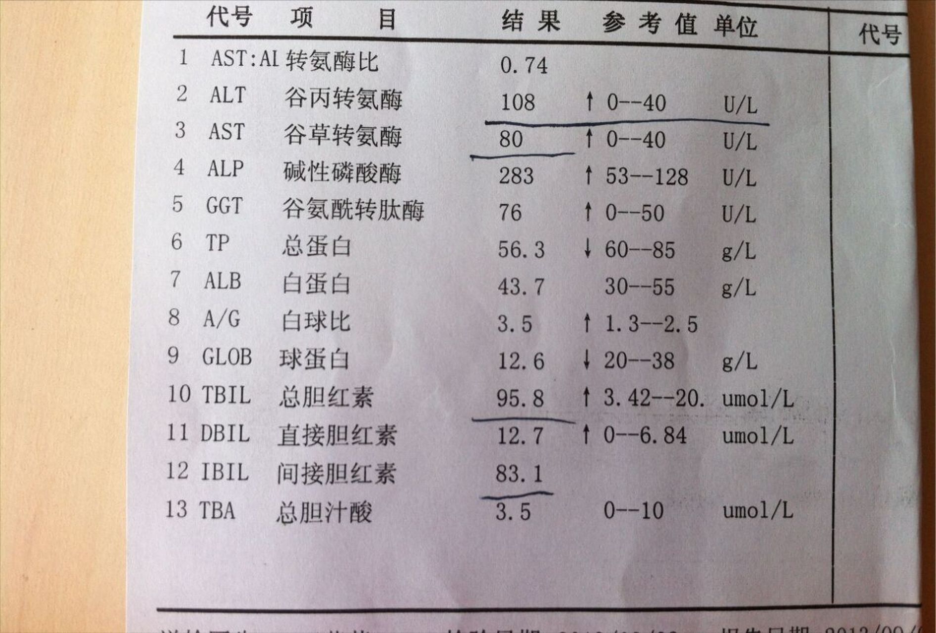 谷丙转氨酶70图片