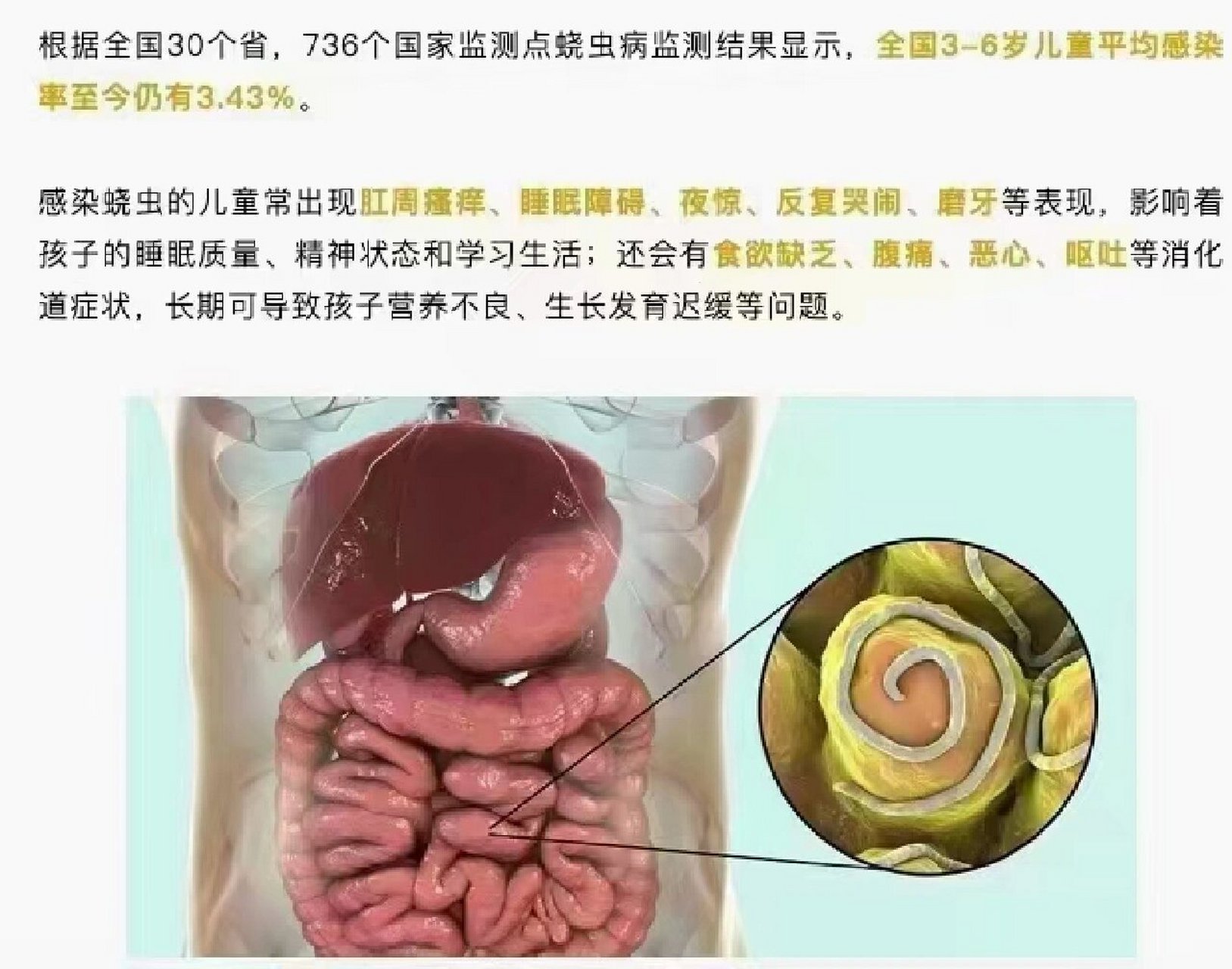 7215感染蛲虫7215 儿童常出现肛周瘙痒,睡眠障碍,夜惊,反复