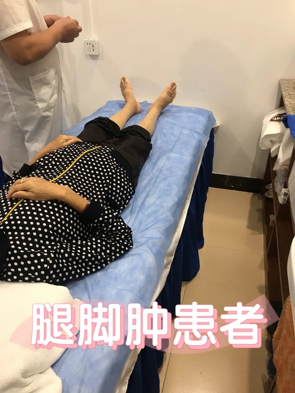 腿脚肿患者,针灸两天消肿了