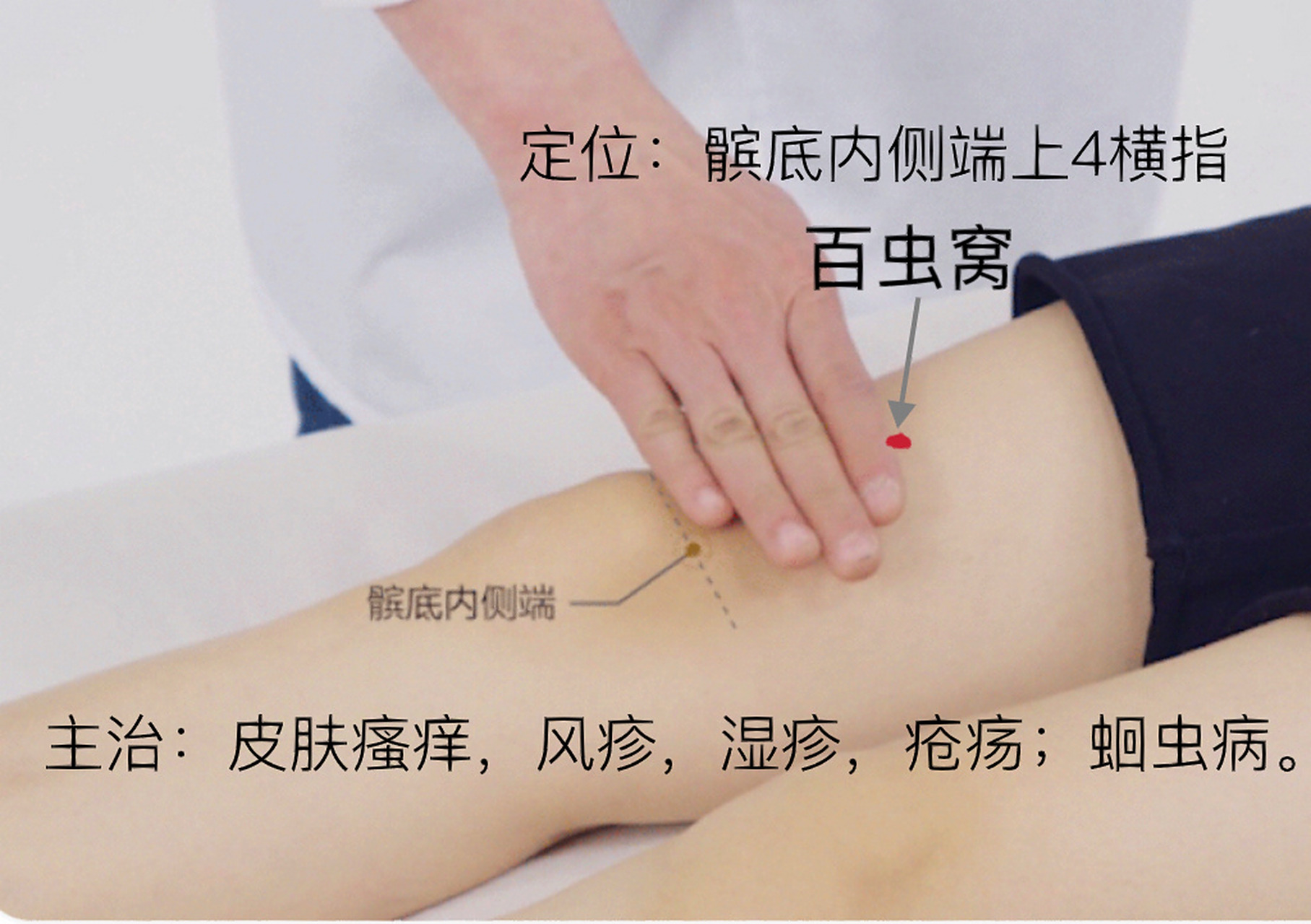主治:皮肤瘙痒,风疹,湿疹,疮疡;蛔虫病. 	 定位:髌底内侧端上3寸.
