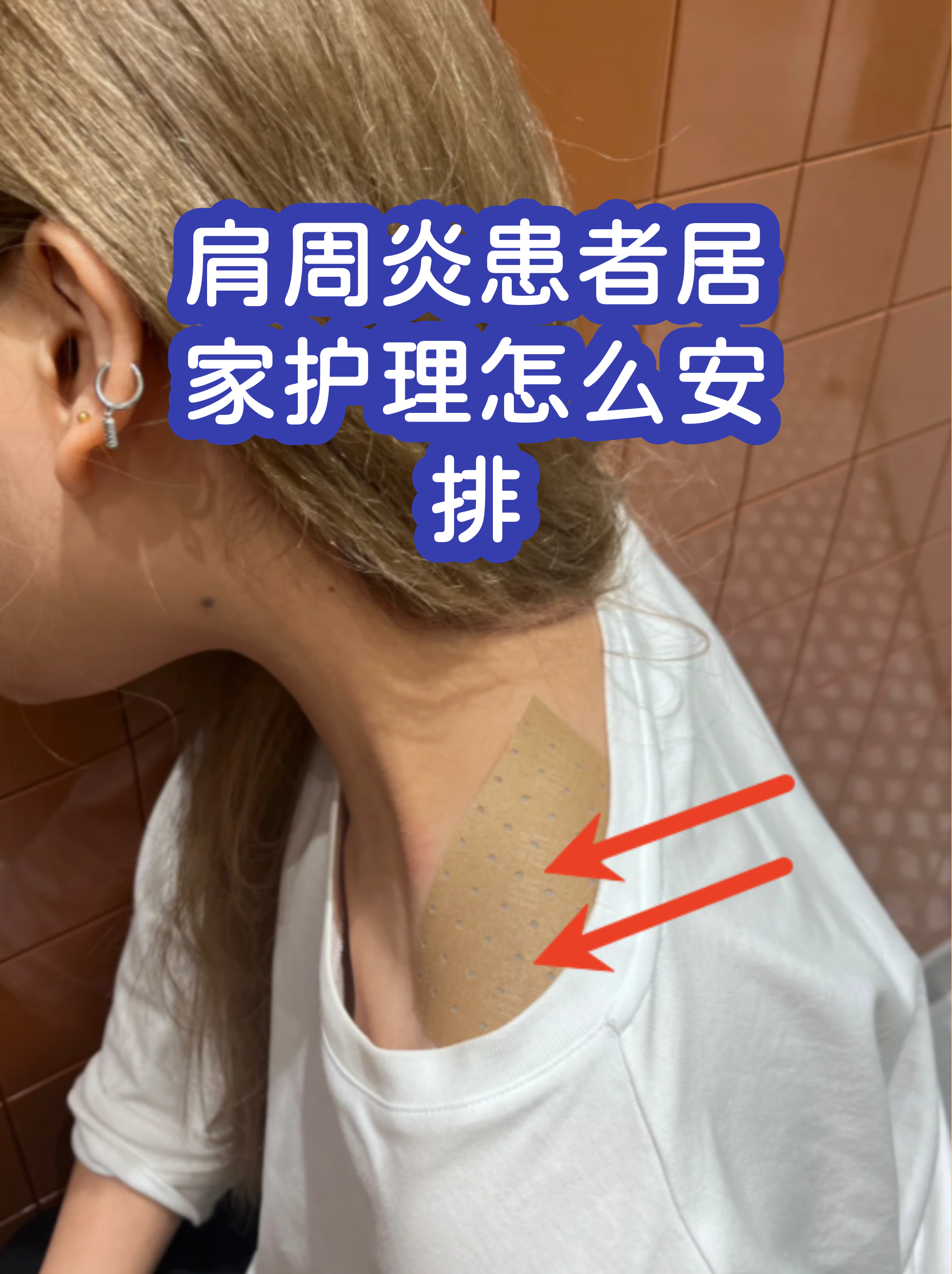 包含安定医院代诊挂号服务出院居家护理提醒，科学恢复身体的词条