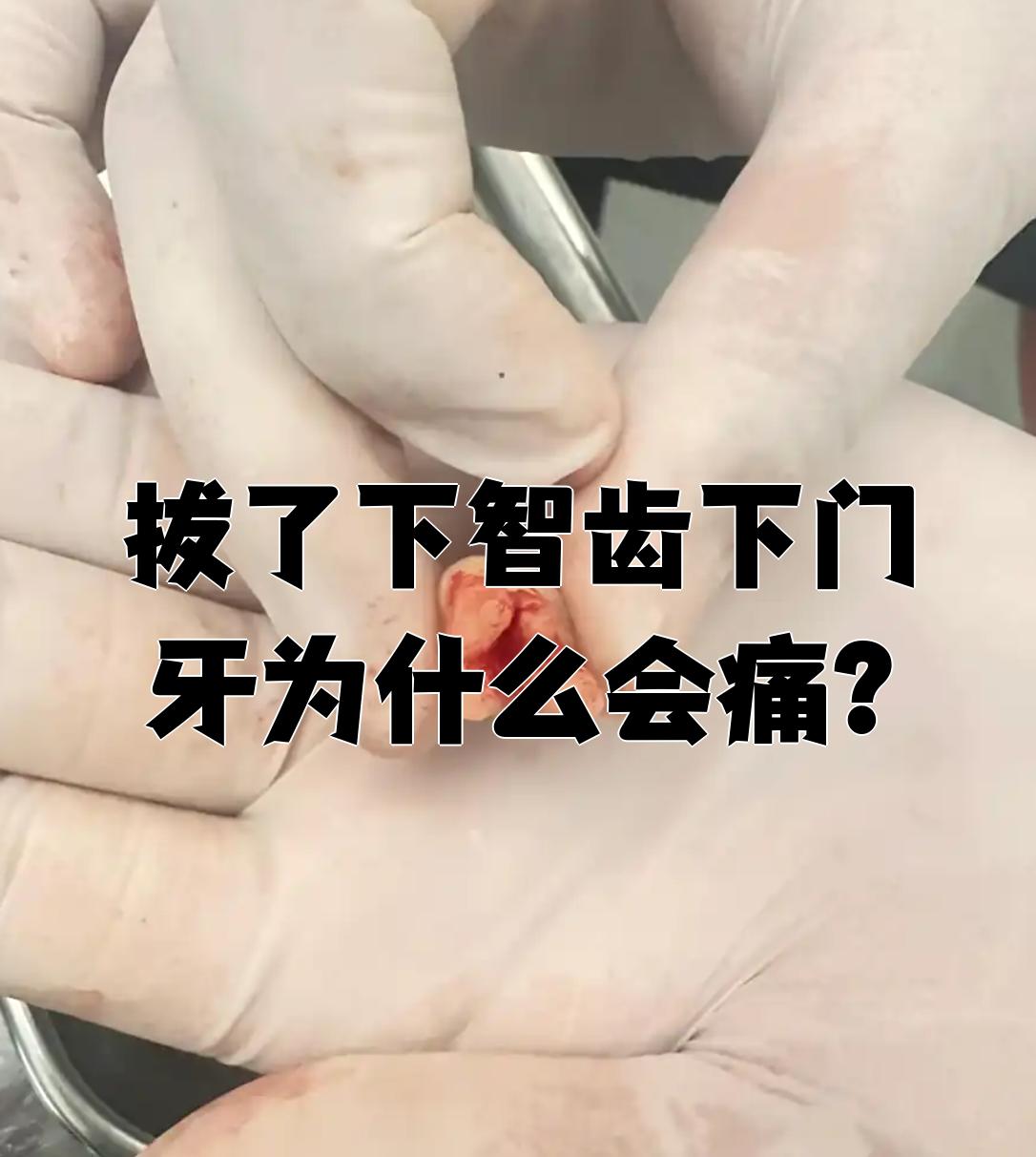 智齿为什么疼