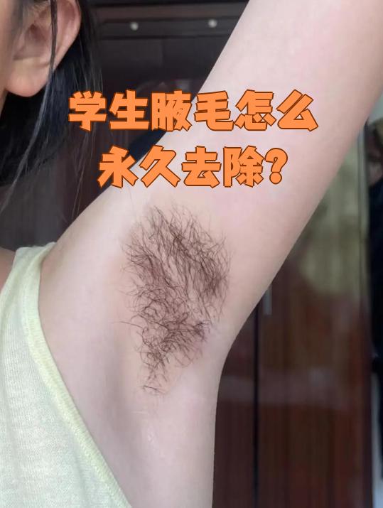 学生想永久去除腋毛,可以选择冰点脱毛或激光脱毛