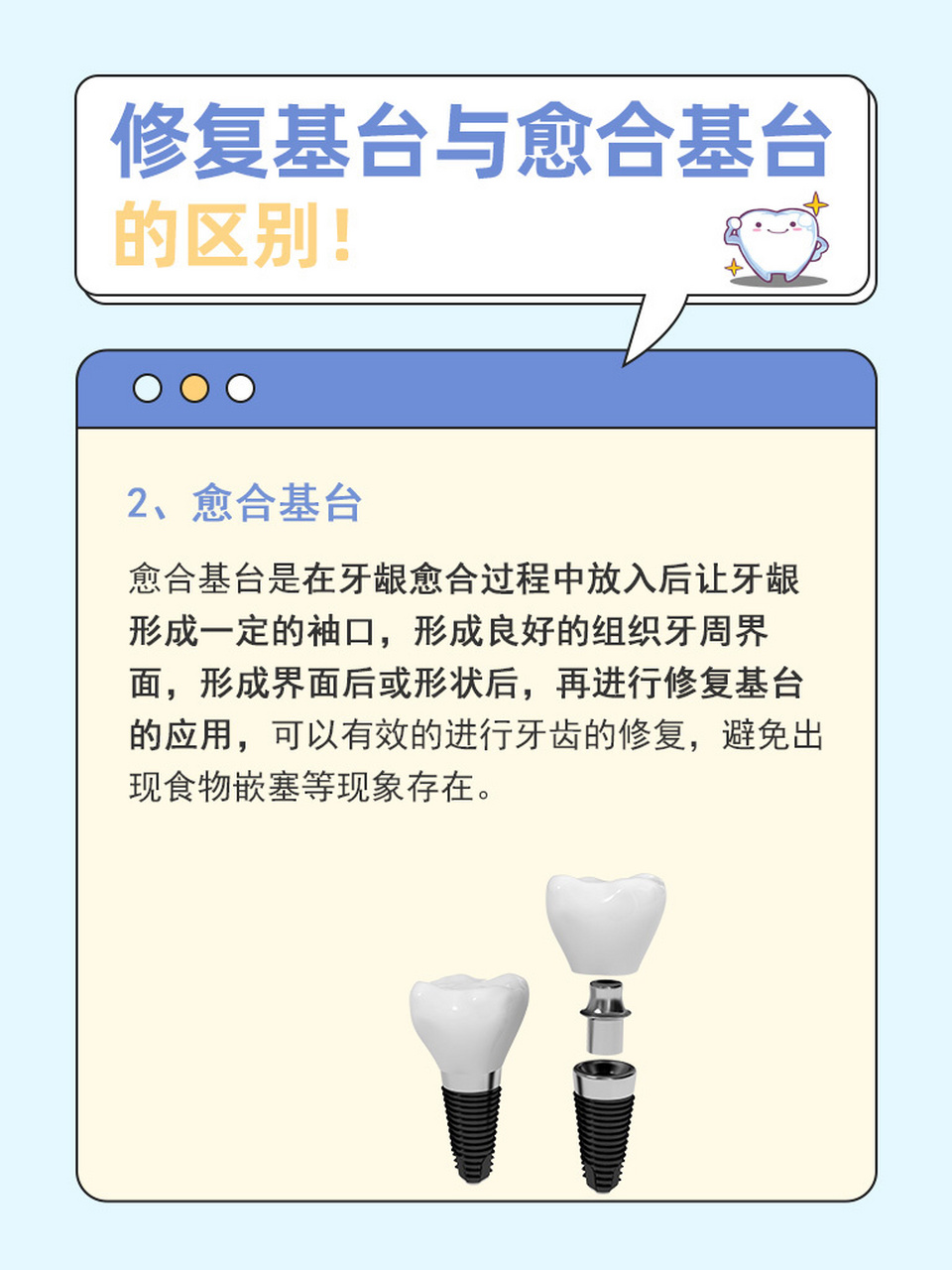修复基台与愈合基台的区别7373 修复基台与愈合基台的区别主要是