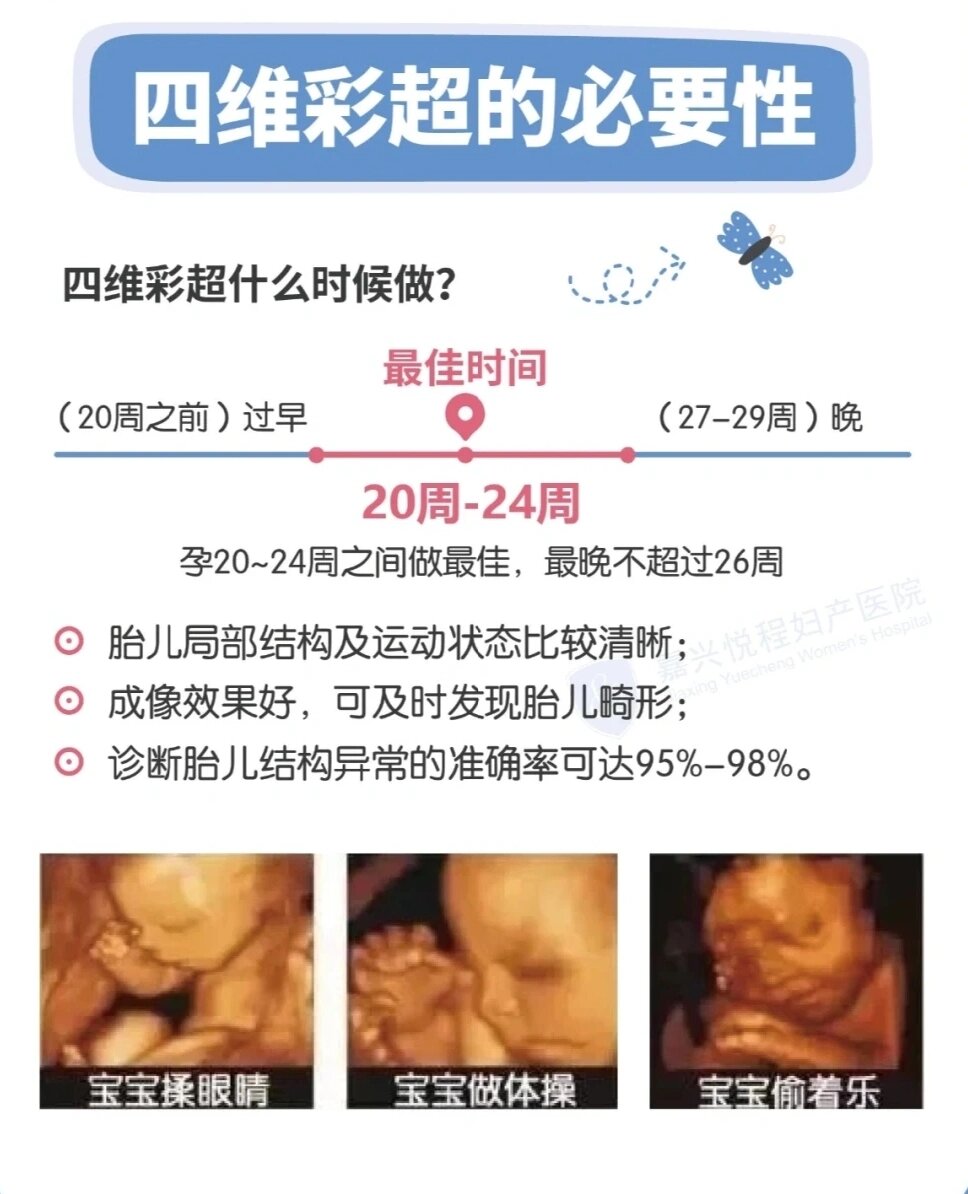 四维彩超最佳时间