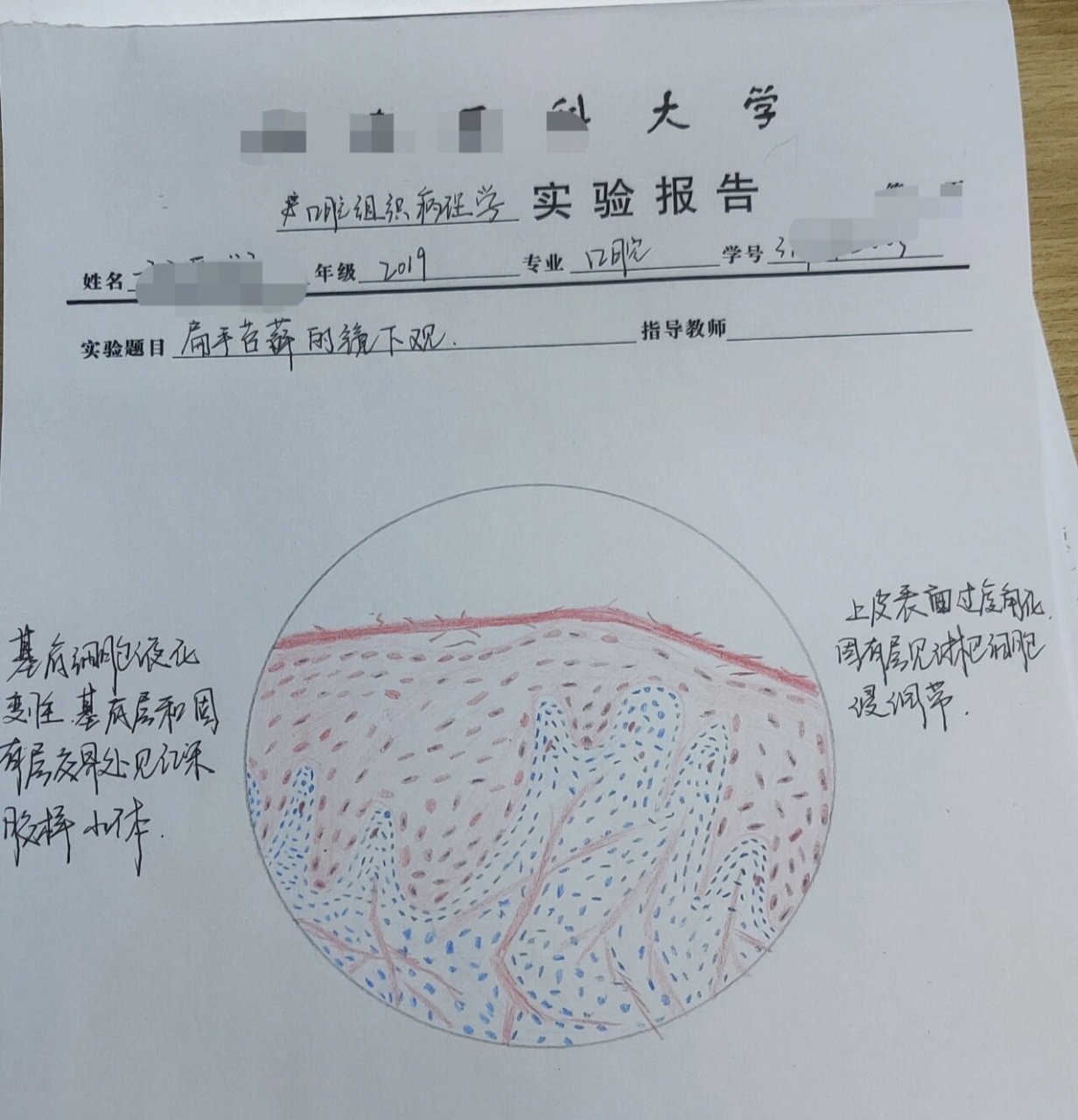 钟状期成釉器红蓝铅笔图片