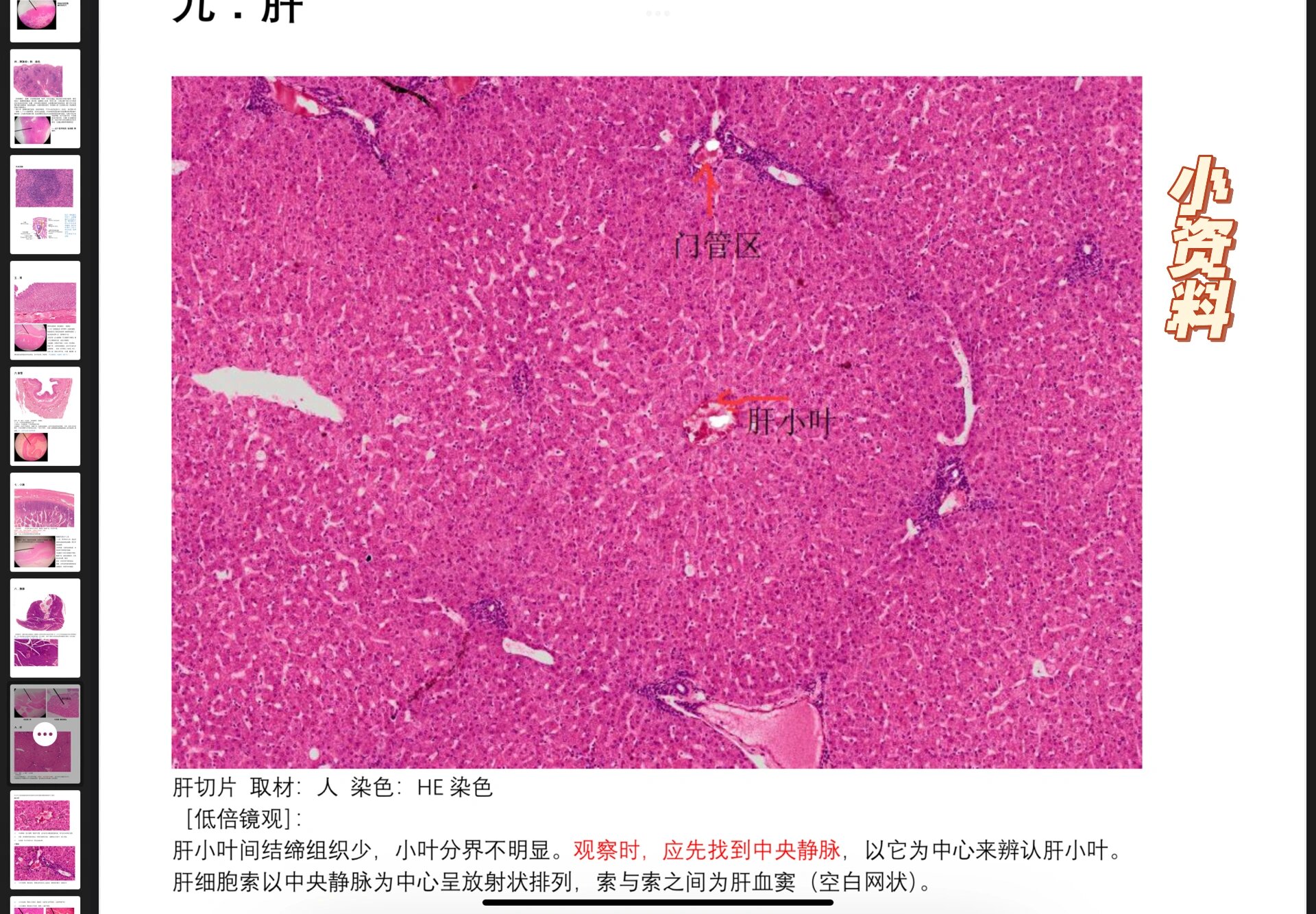 肝小叶中央静脉手绘图图片