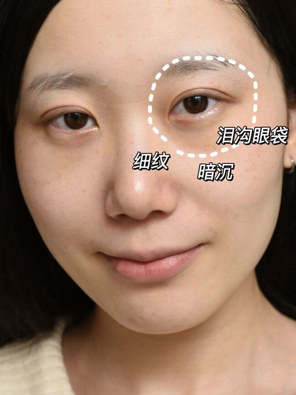 打工人必备的就是眼袋细纹泪沟 天天对着电脑晚上一照镜子都被自己