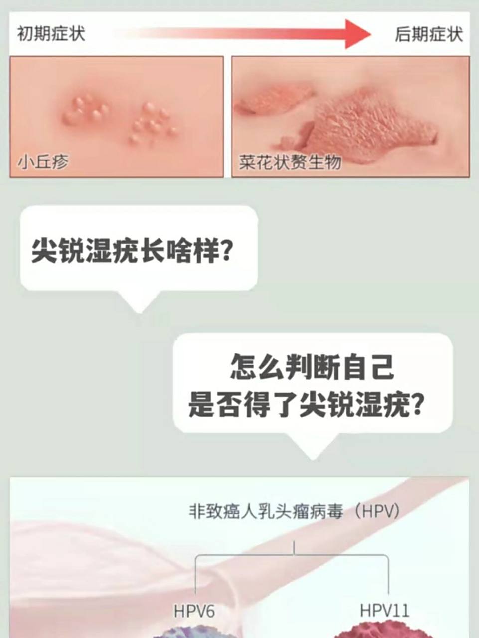 尖锐湿疣长啥样71怎么判断自己是否得了尖 98 尖锐湿疣损害初起为