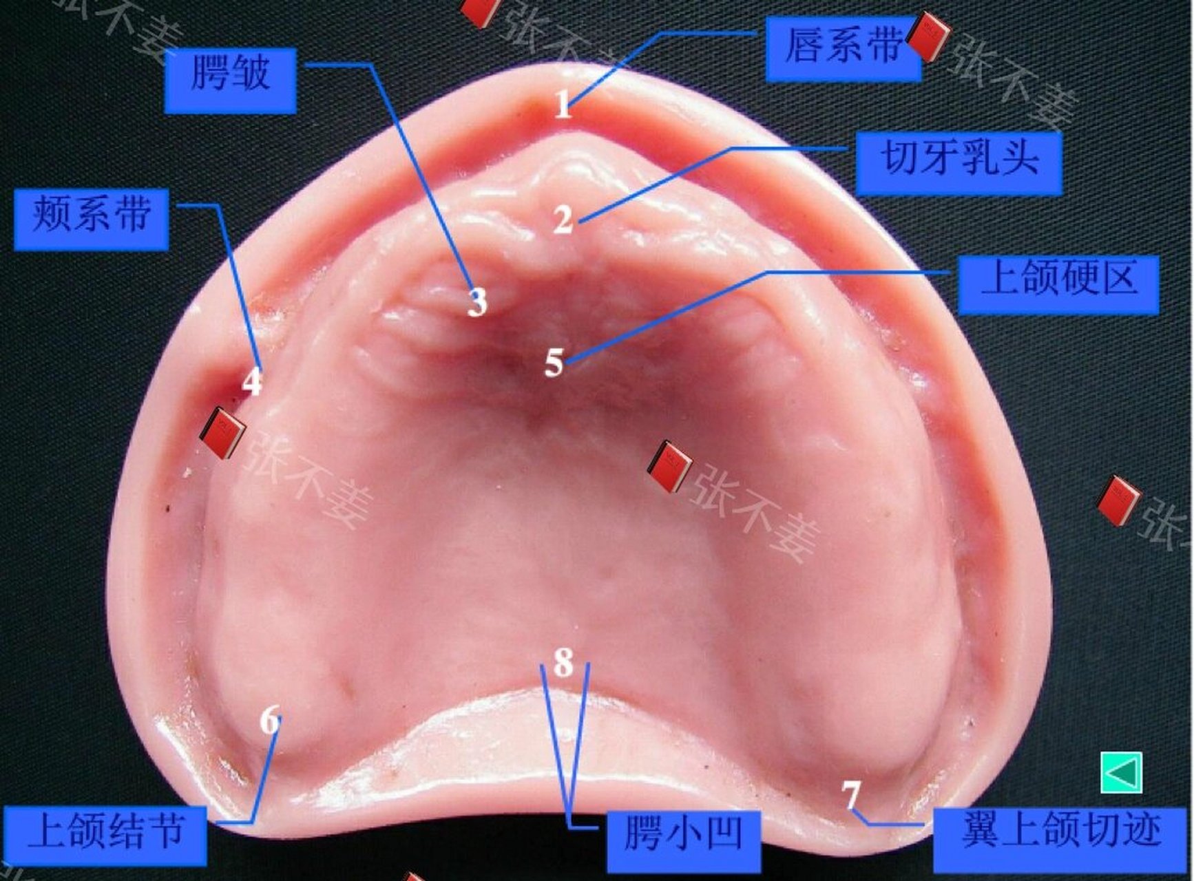 上唇系带图片图片