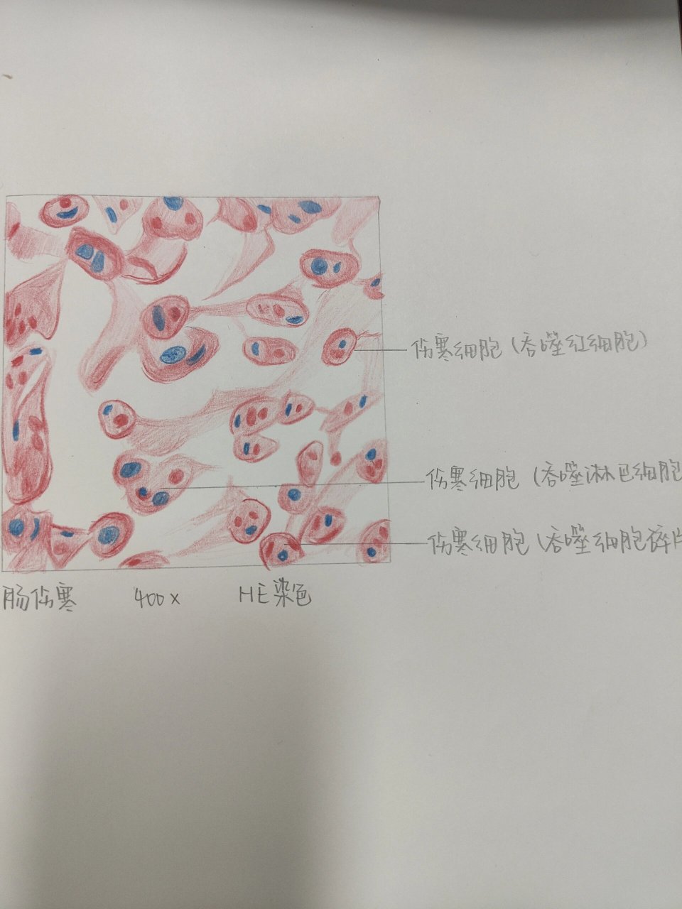 浆液性腺泡手绘图图片