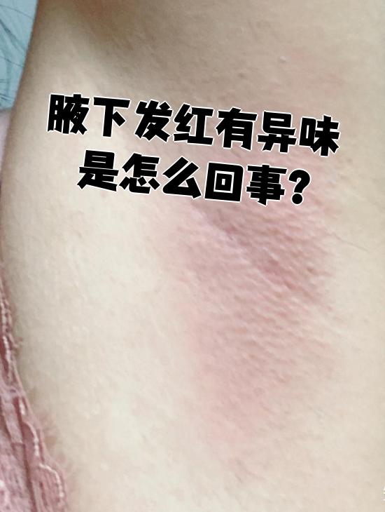 为什么腋下有异味